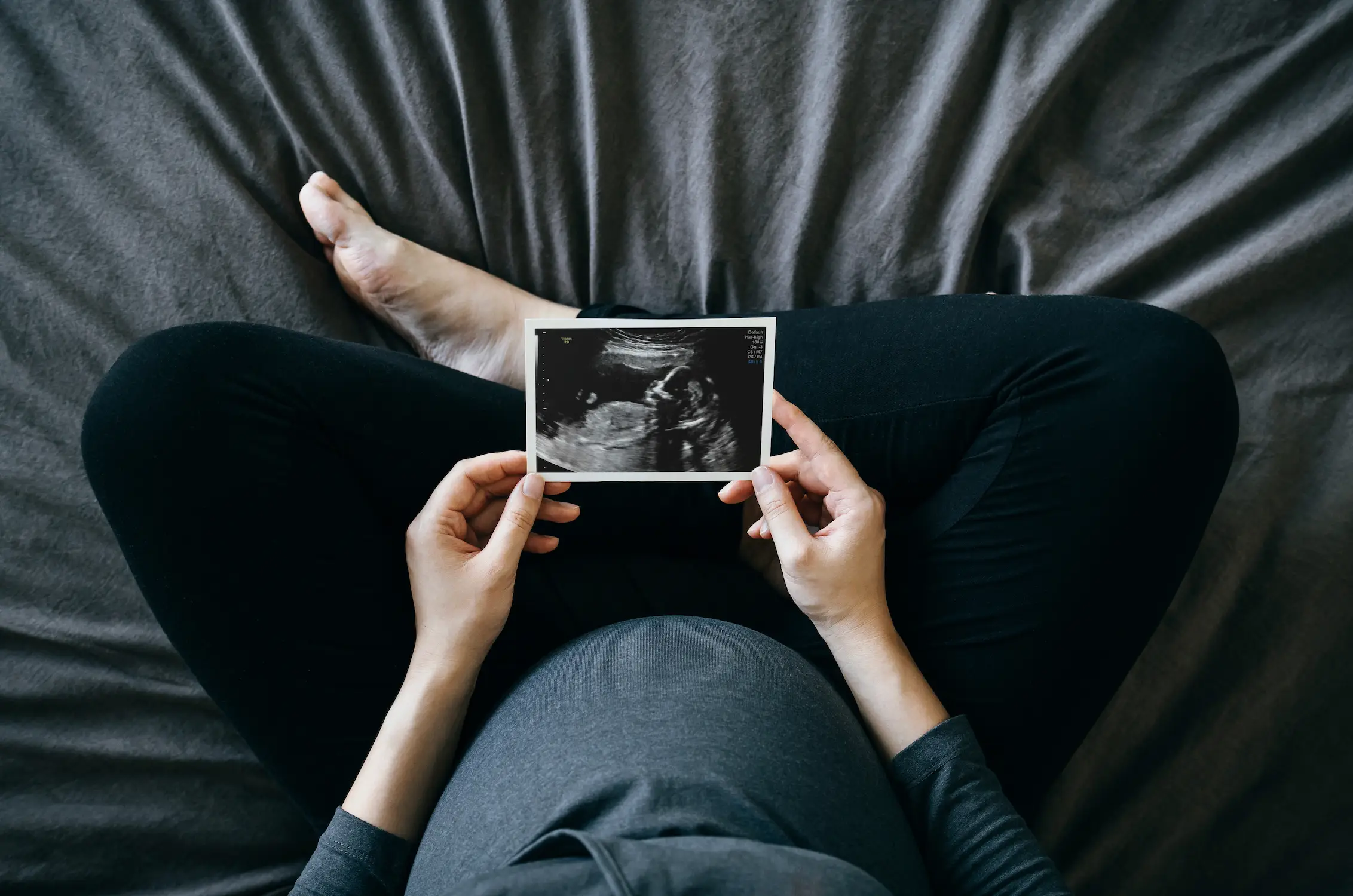 The couple reportedly sought an abortion on the basis that their son was born with a cleft lip (Getty Stock Images)