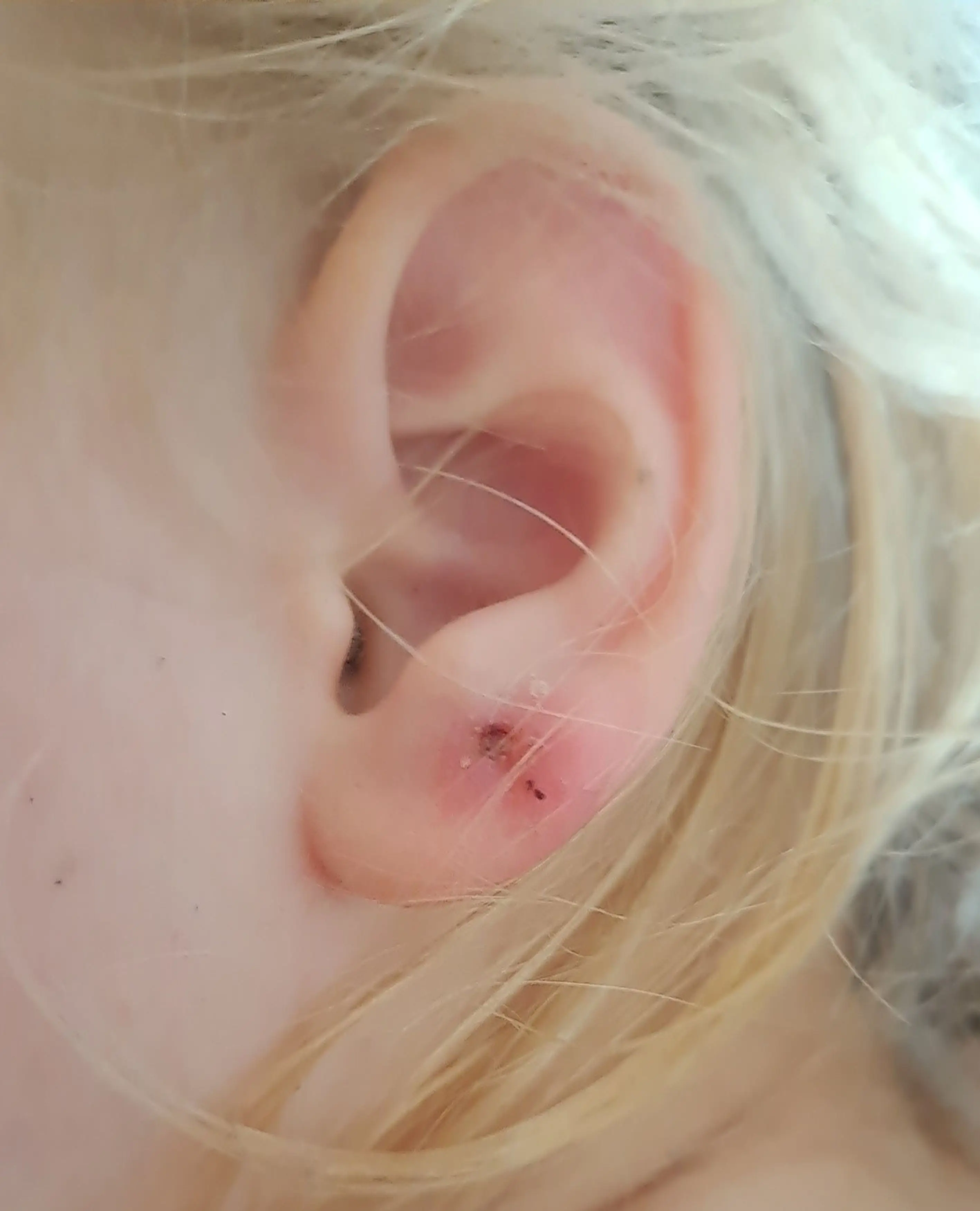 Ava's wounds have since healed better than expected.