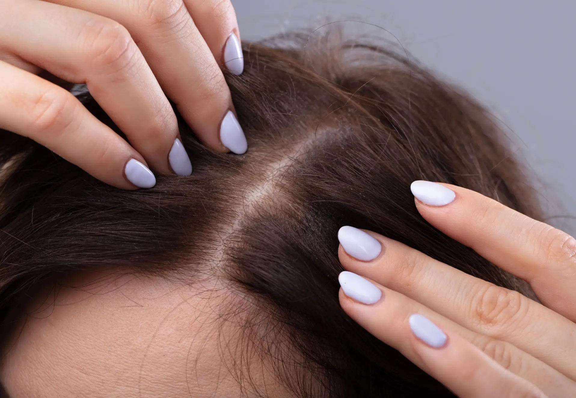 Hair growth could suffer (AndreyPopov/Getty Images)