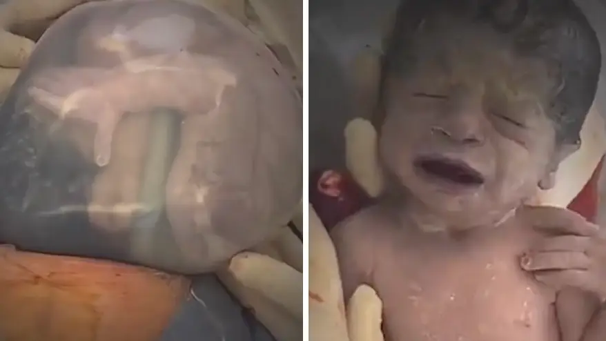 Dr Ignacio Perez Tomasone