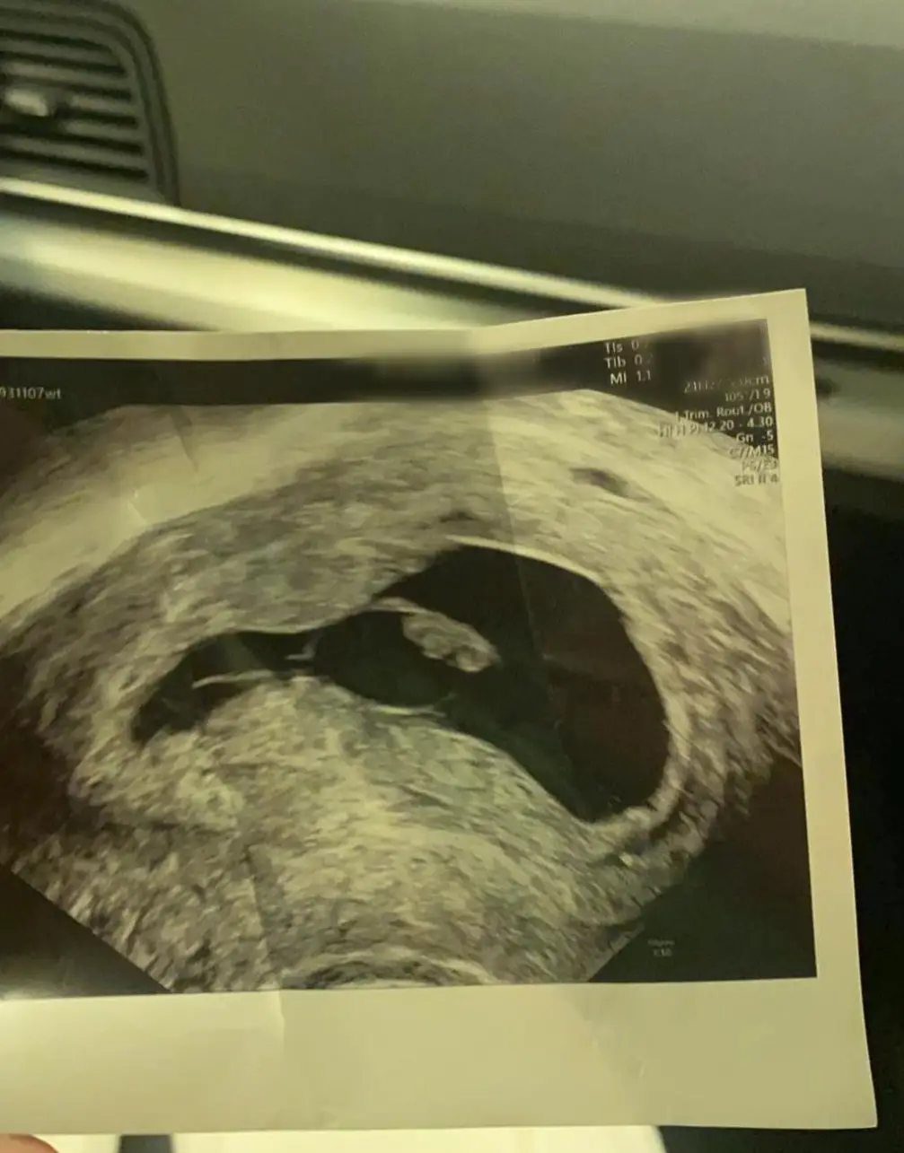 Tiffany hopes the shed the stigma around talking about miscarriages. (