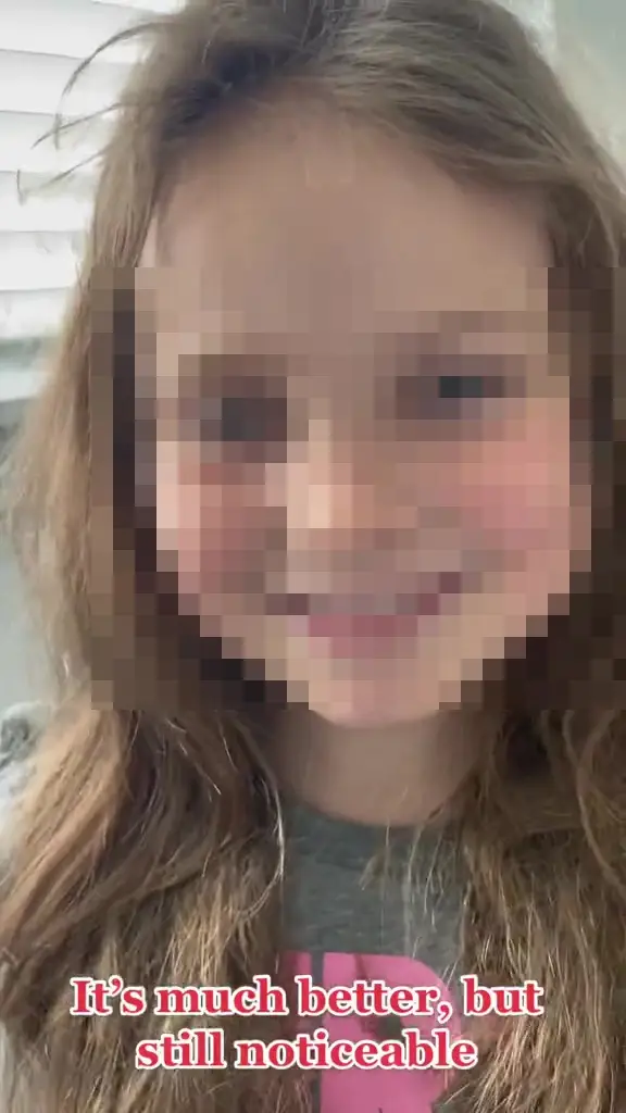 Although her daughter has recovered, the internet has been deeply divided by the decision.