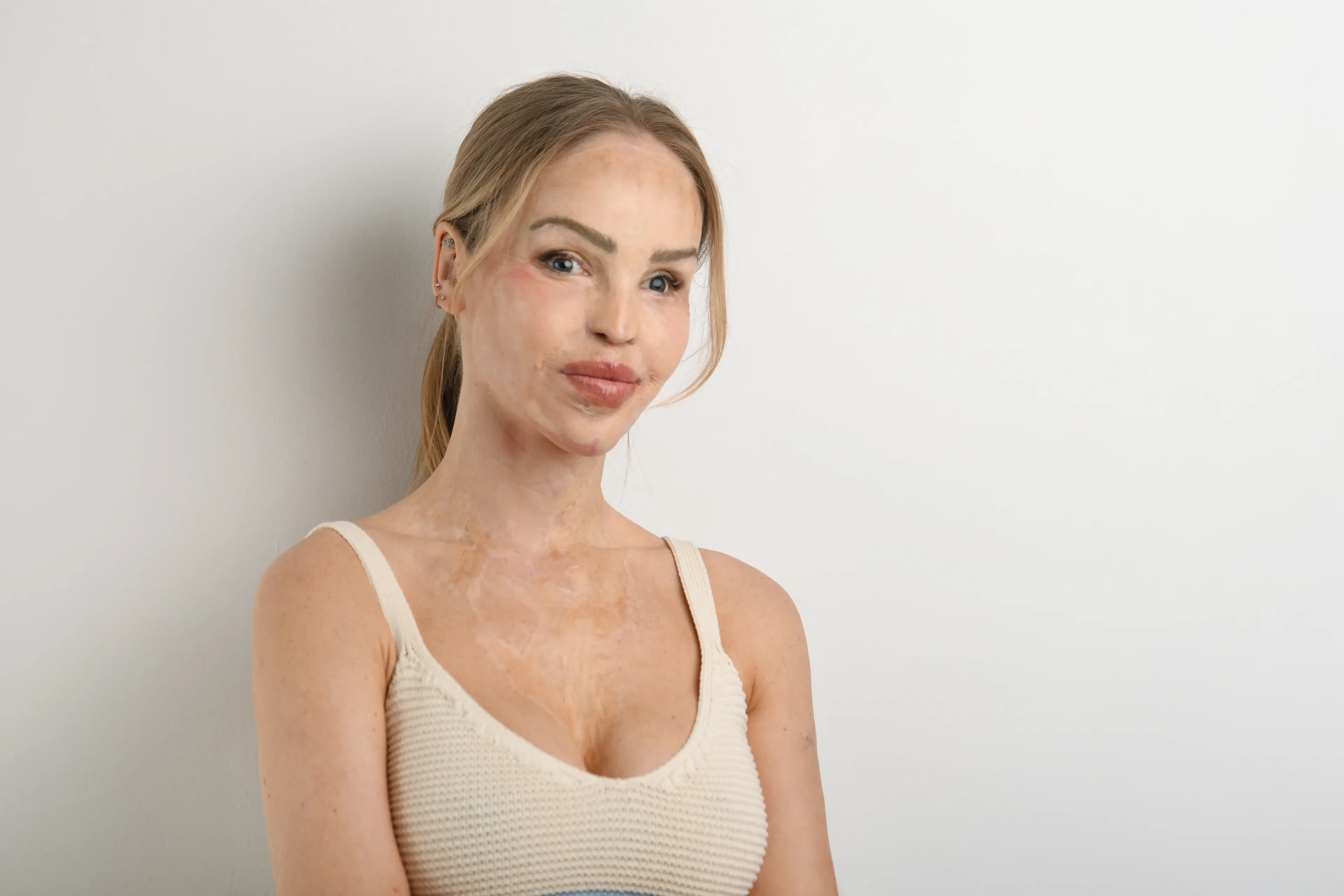 Katie Piper has opened up to Tyla about narrow beauty standards, what it's like ageing as a woman in the media and her latest project (Zak Walton)