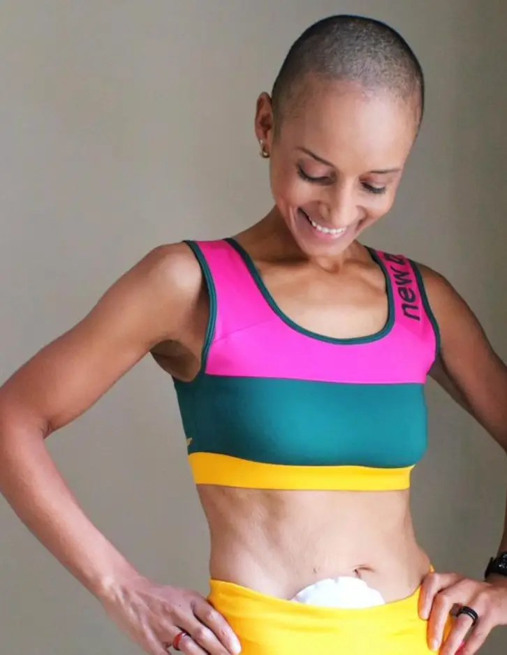 Adele showed off her stoma in a post on Instagram.