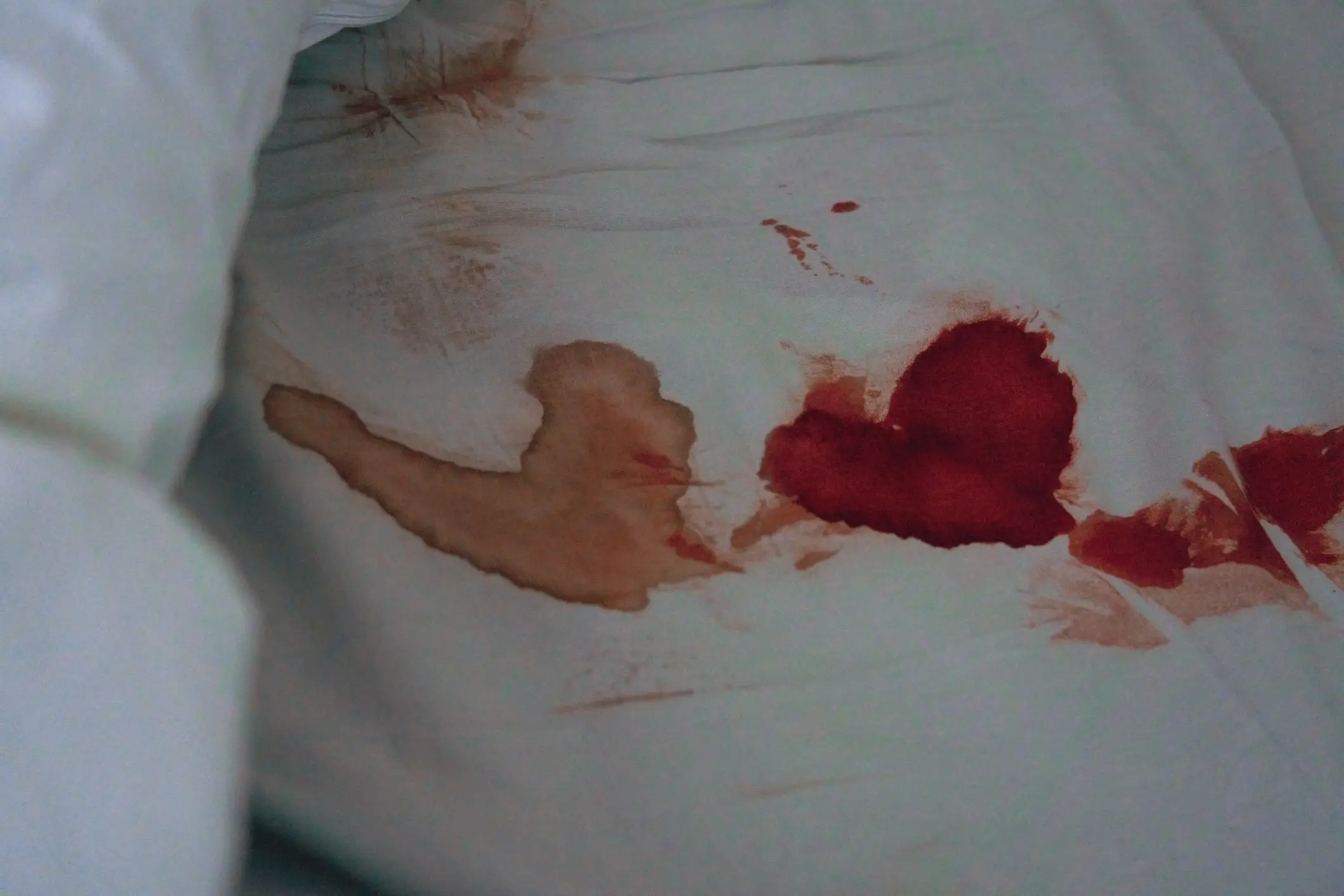 Heavy periods could be down to hormone imbalances (Getty Stock Images)