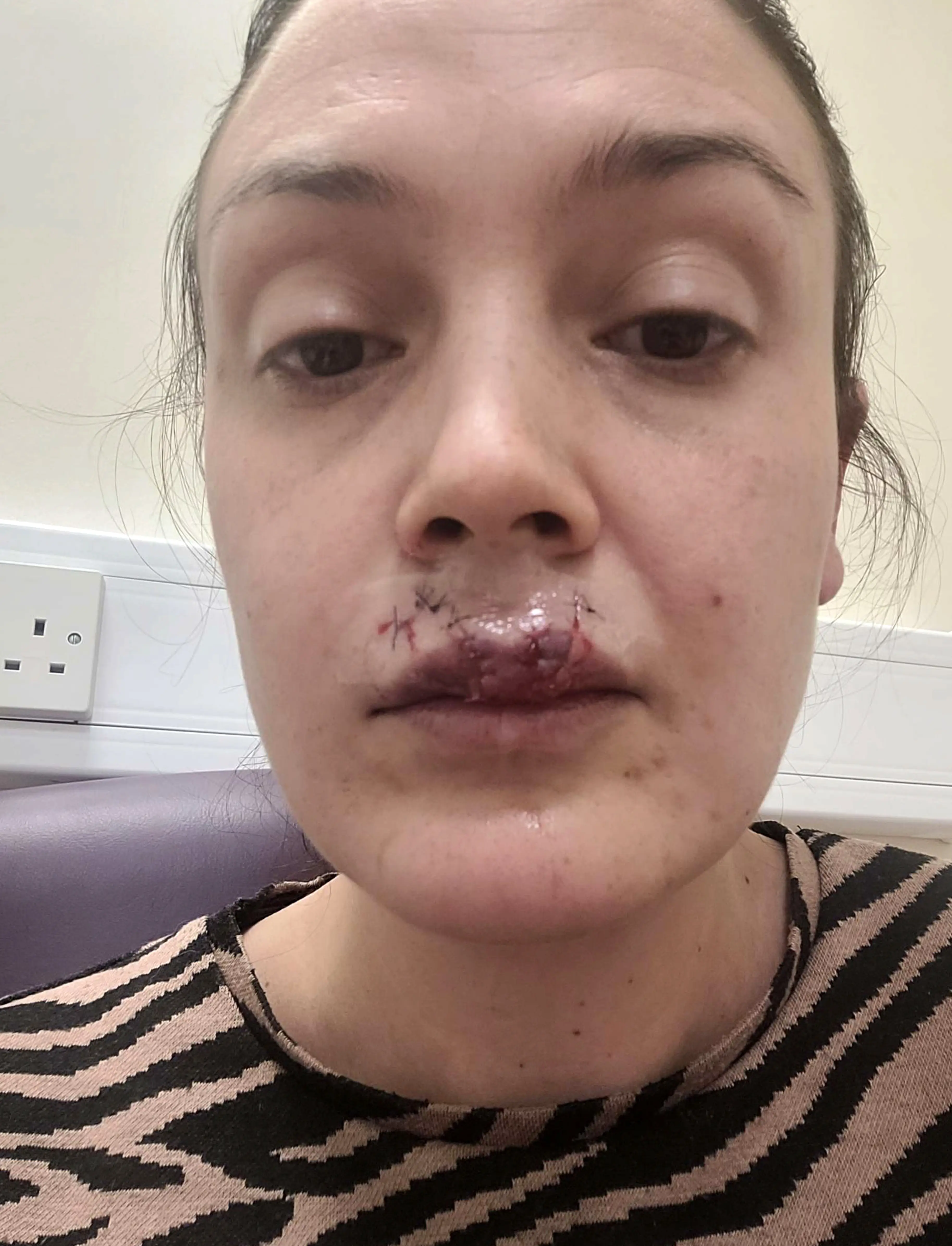 Emma was attacked by her beloved family dog Hobo.