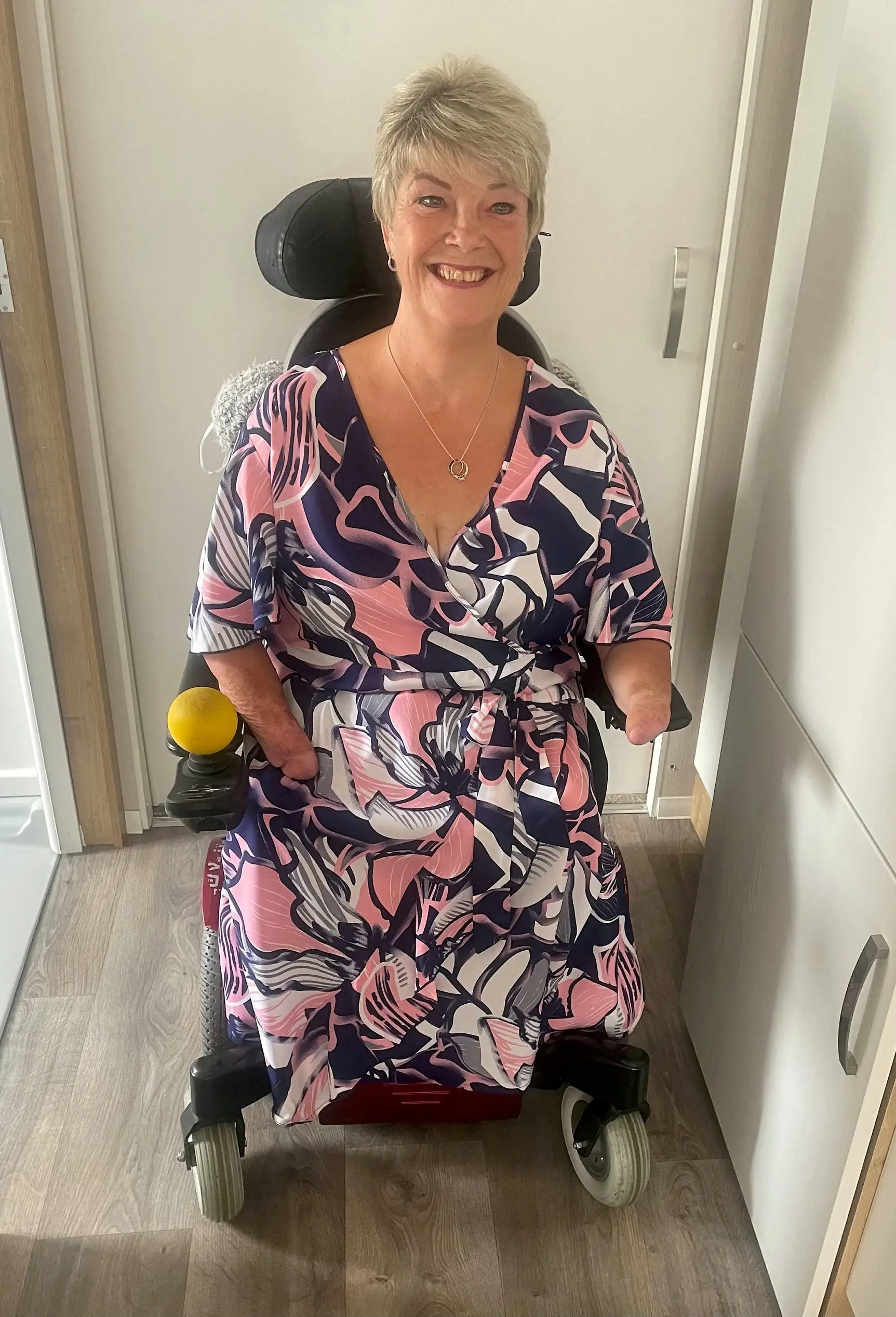 She had both of her hands amputated.