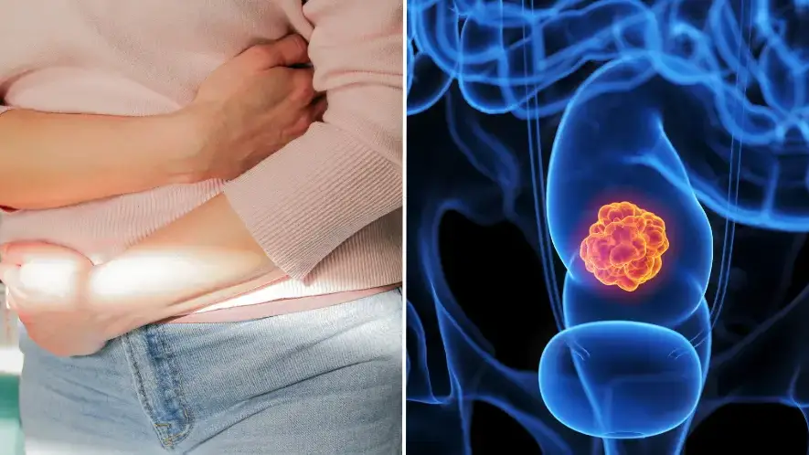 How to break common food habit which has caused surge of colon cancer cases in Gen Z and Millennials