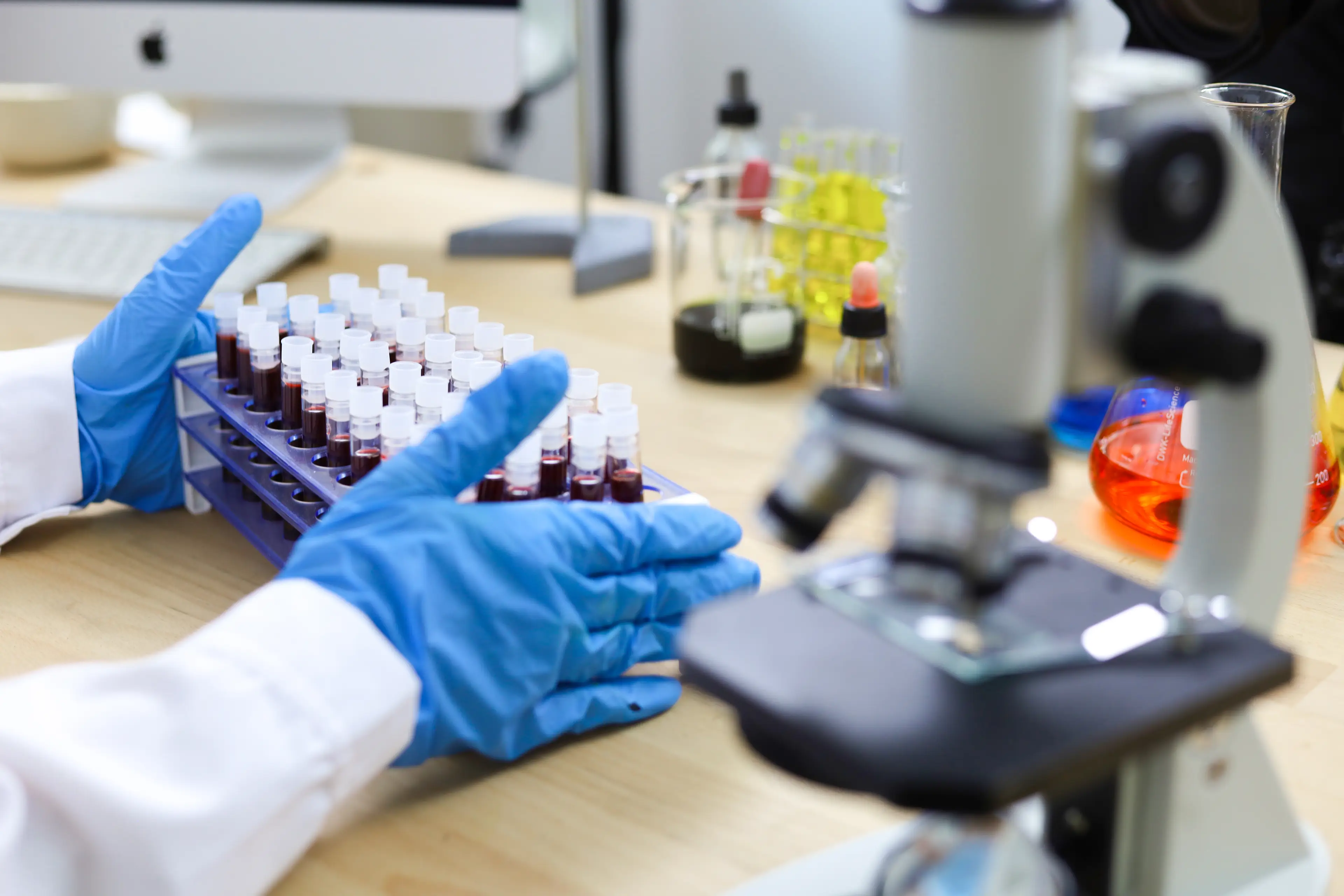 Blood tests determine which category you're in (krisanapong detraphiphat/Getty)