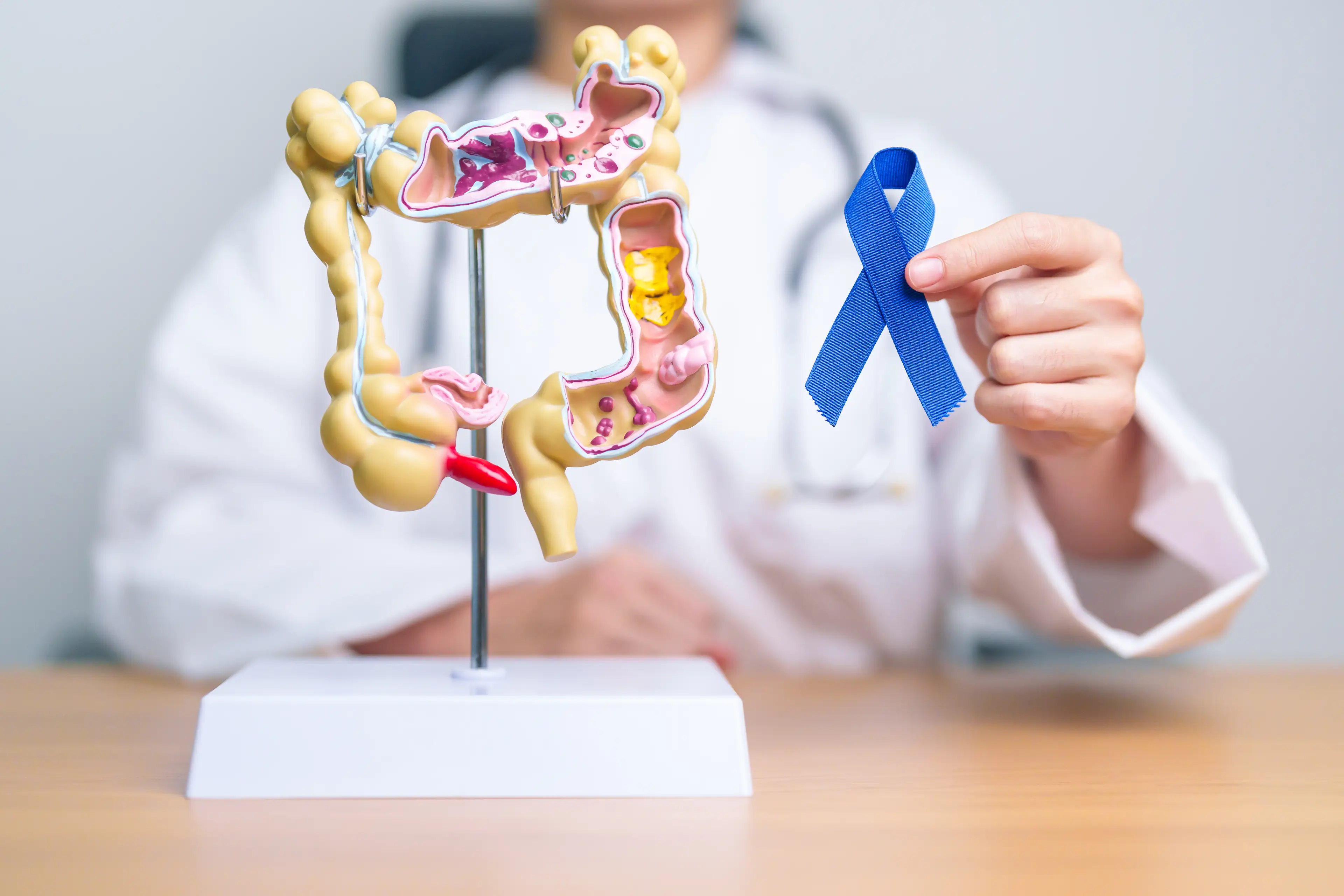 Colon cancer cases are on the rise in young adults (Panuwat Dangsungnoen/Getty)