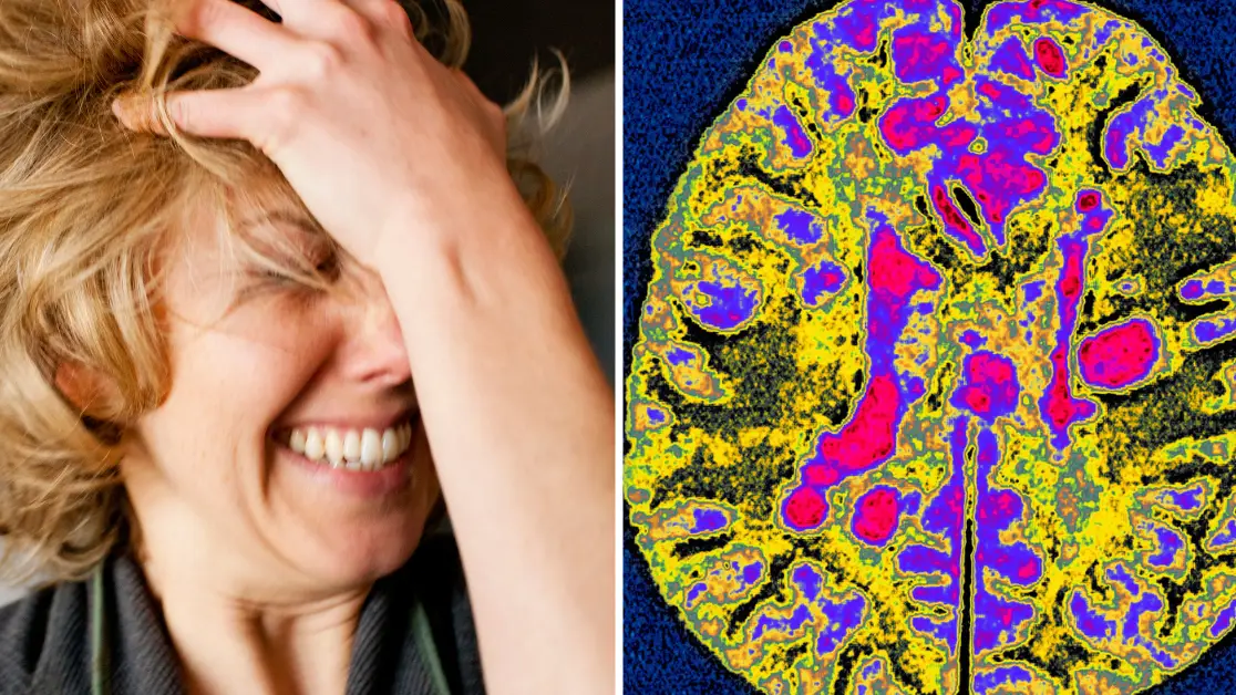 Awkward trait that could actually be a symptom of MS