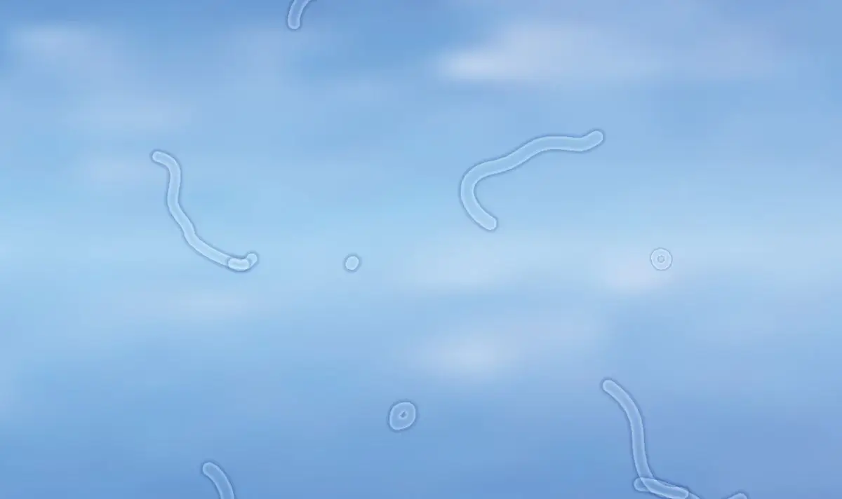 Eye floaters can appear in a variety of shapes, such as squiggles (Getty stock image)