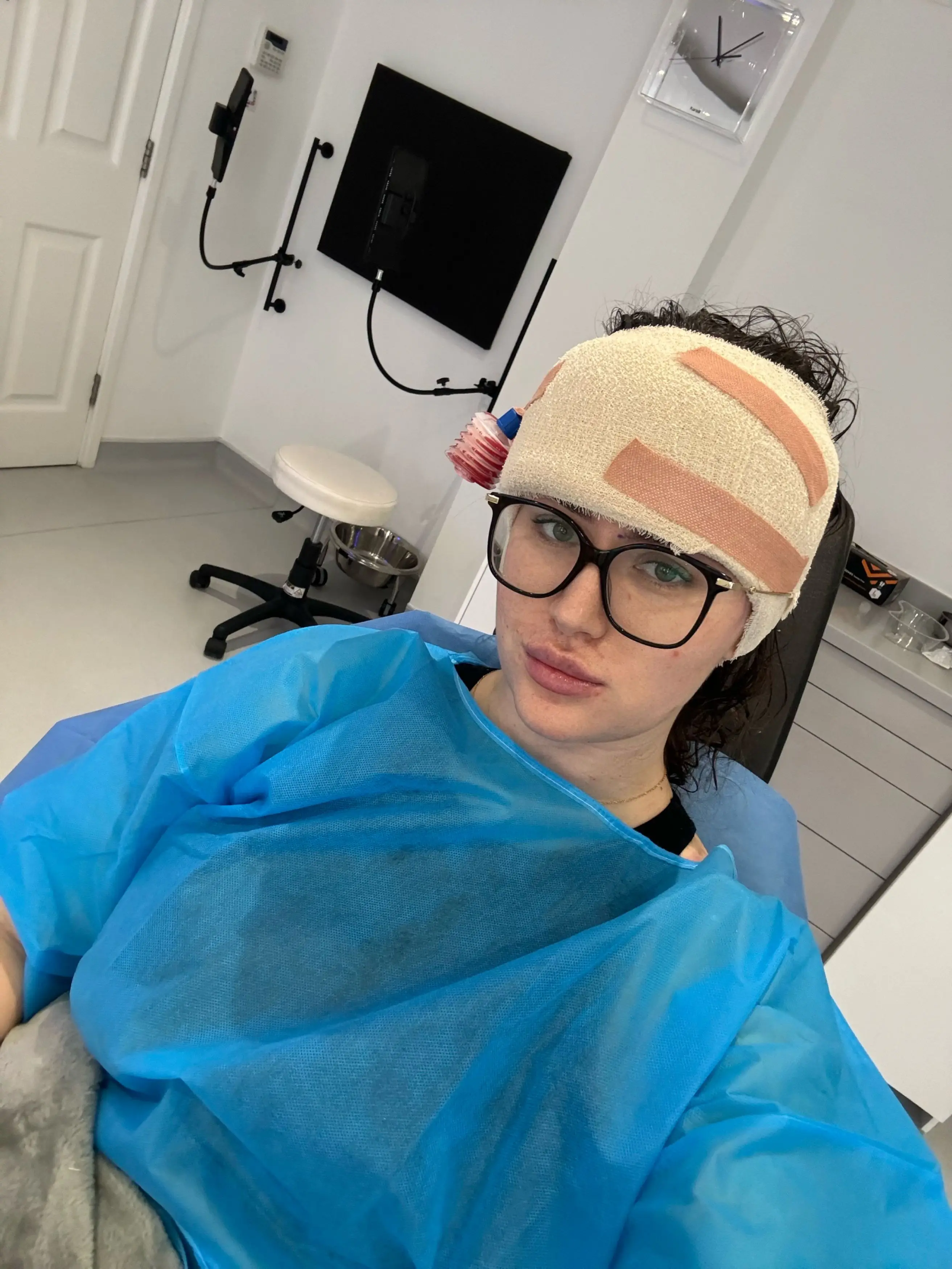 Beth went under the knife earlier this month (5 March).