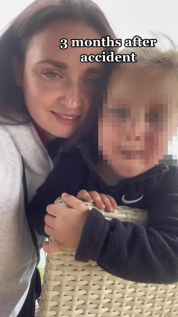 Milana was just three years old when the horrific accident happen.