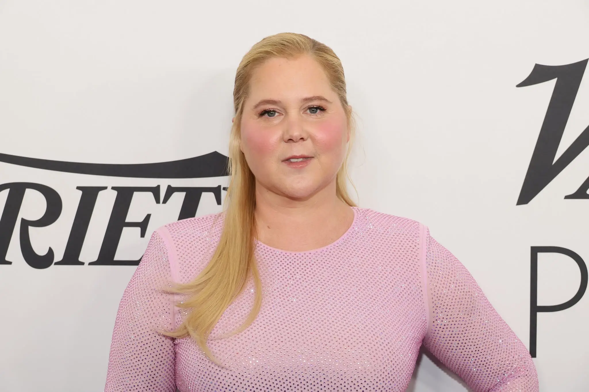 Amy Schumer's 'moon face' led to a lot of online comments (Dia Dipasupil/Getty Images)
