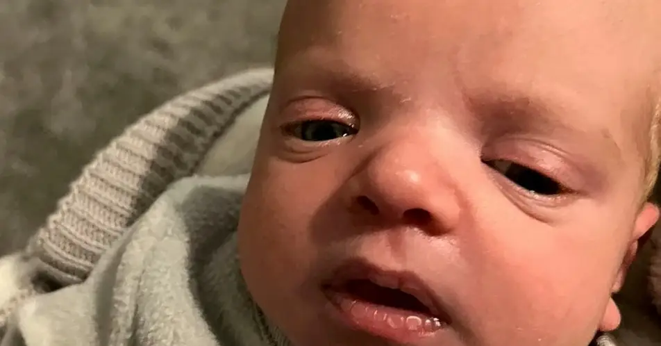 Zander was diagnosed with Chromosome Deletion Syndrome.