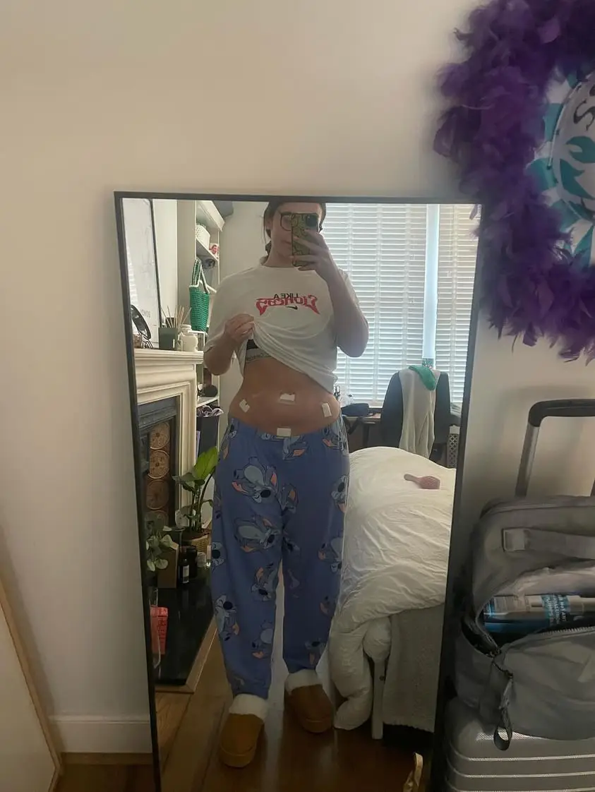 Overall, it took about 14 years for Jess to get a diagnosis.