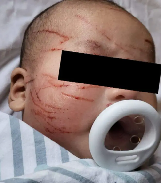 The mum said she doesn't 'even want to click the images' of her son.