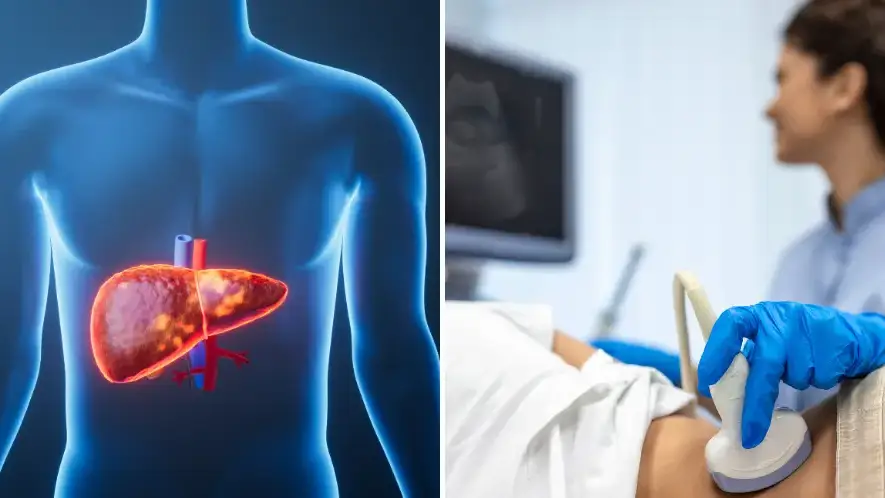 Doctor issues warning over five signs that could mean you have serious liver damage