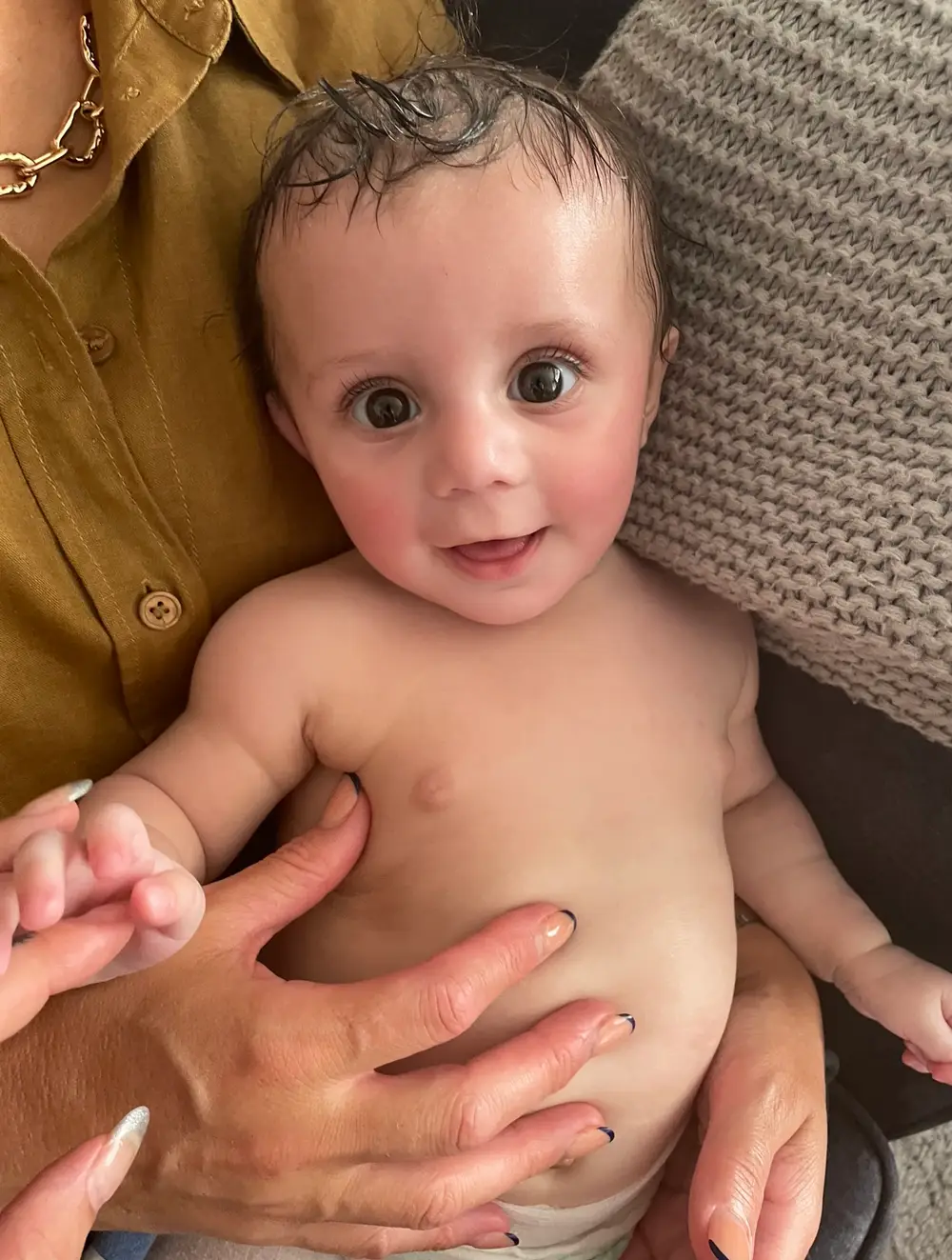 Her skin has since improved with a 'miracle' £8 skin product.