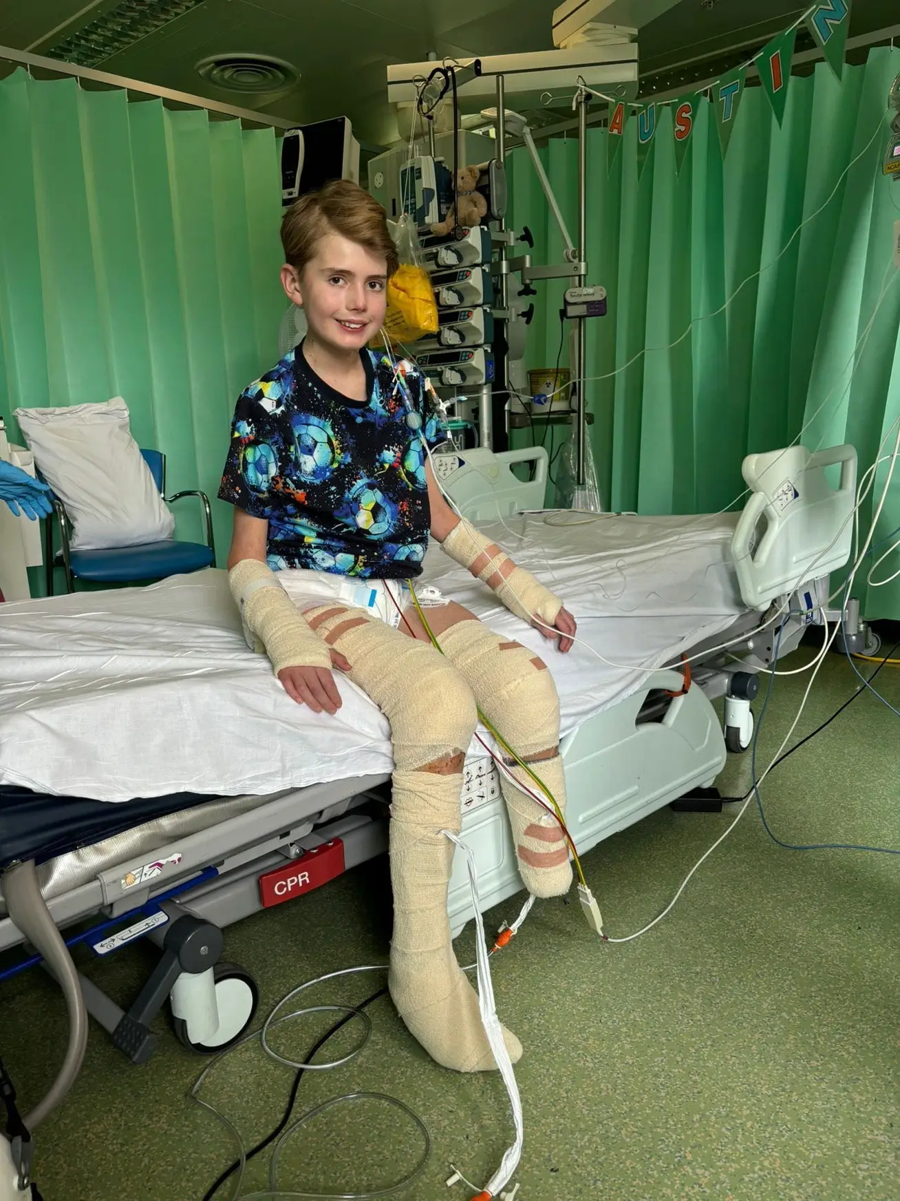 Austin elected to have both legs amputated due to the pain following the sepsis (SWNS)