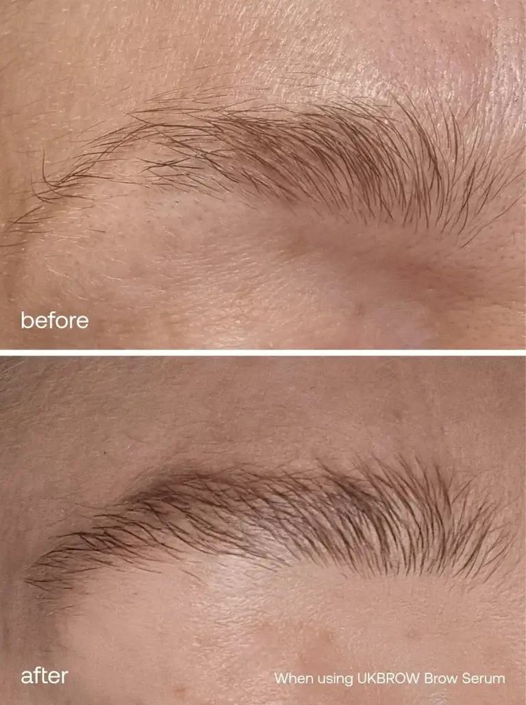Before and after results of the UKLASH brow serum (UKLASH)