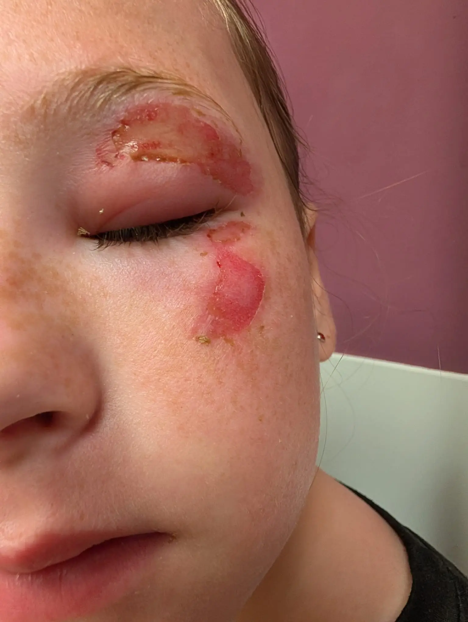 Medics have reported a 'growing number' of children reporting burns caused by squishy toys (Glasgow City Council)