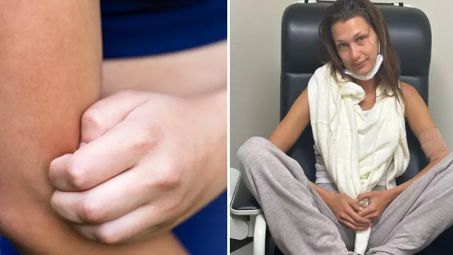 Catherine McQueen/Getty Images / Instagram/@bellahadid