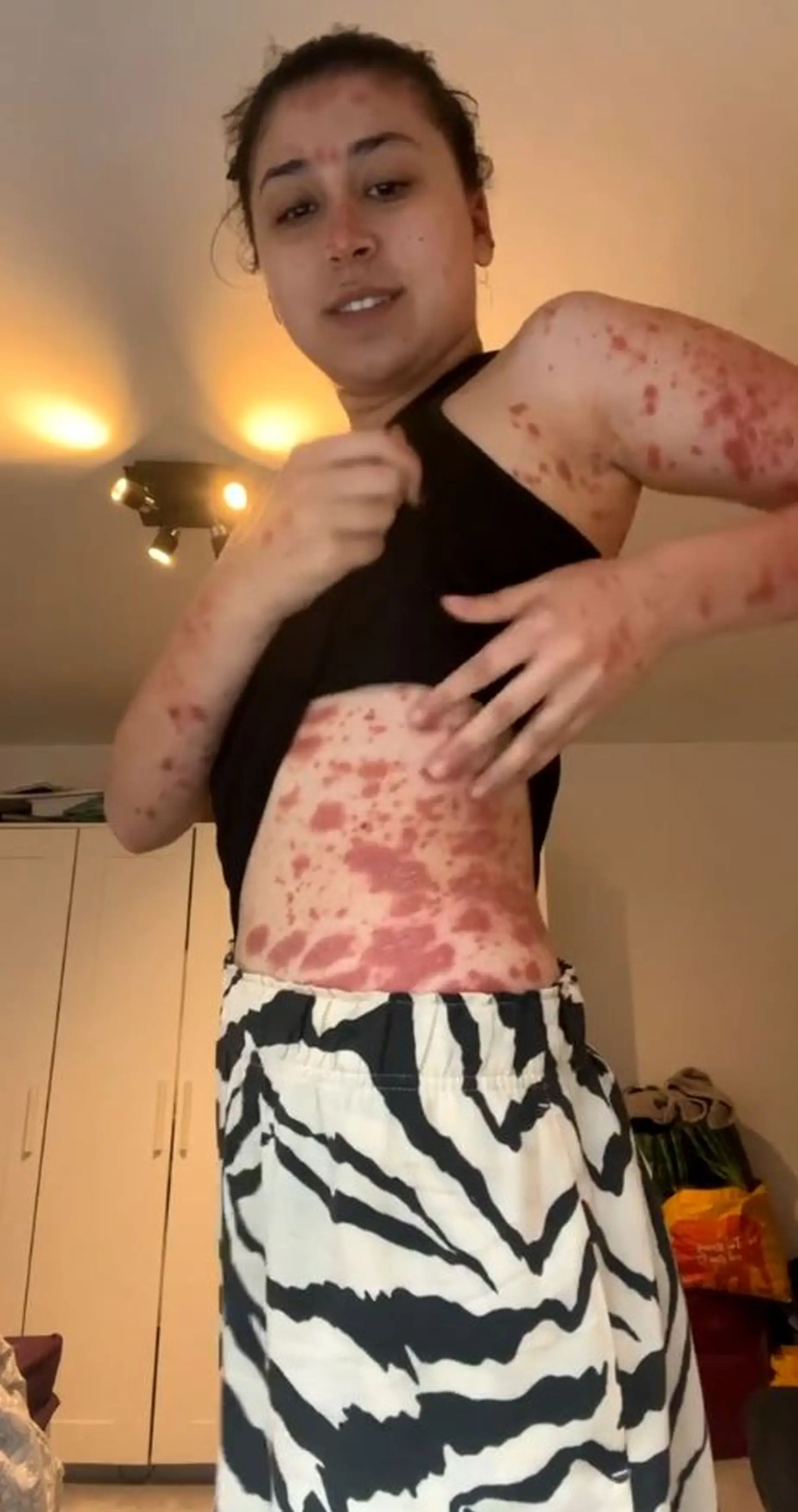 Emily is sharing her story to raise awareness.