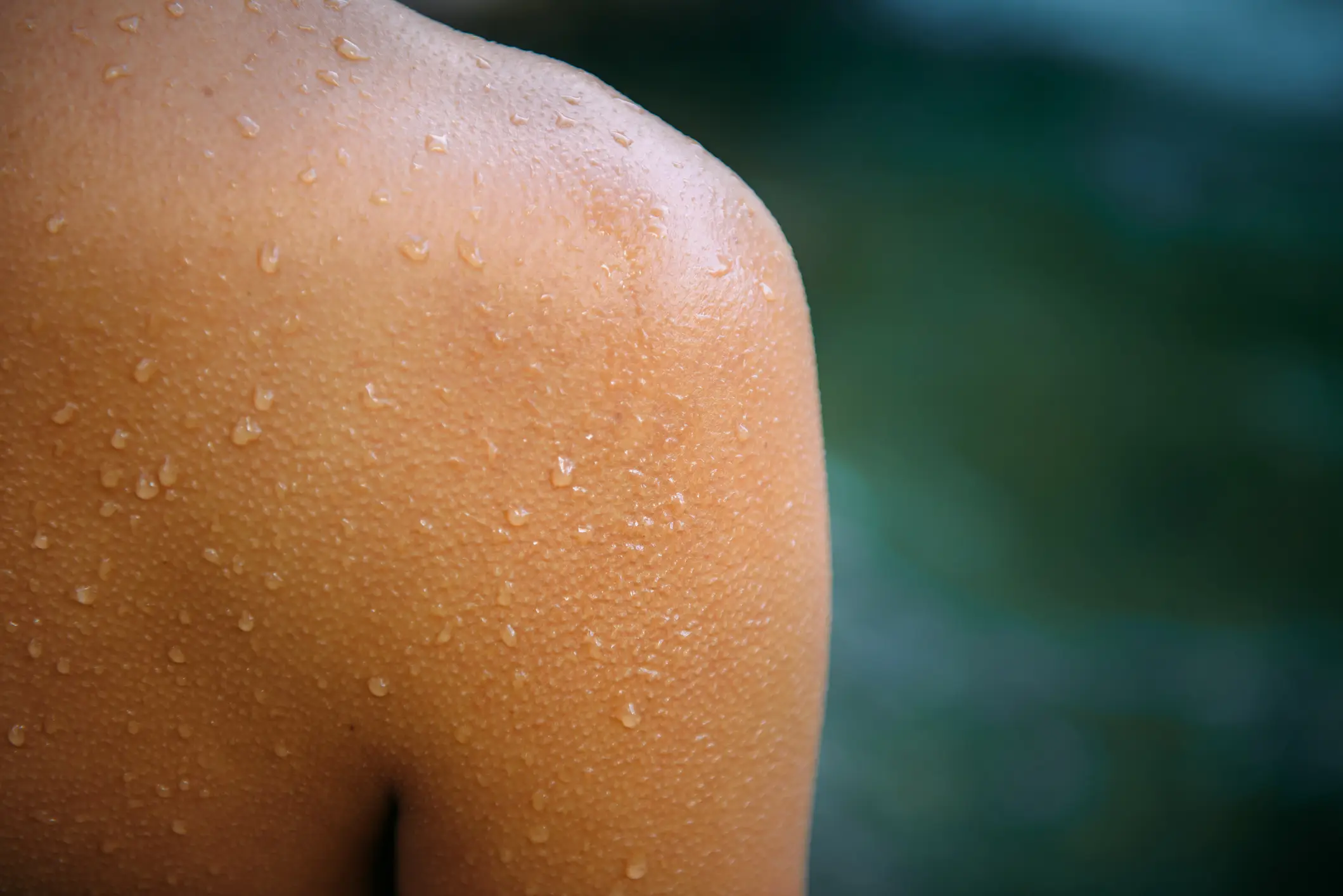 Such medication has been found to trigger excessive sweating. (Ekaterina Bubnova / Getty Images)