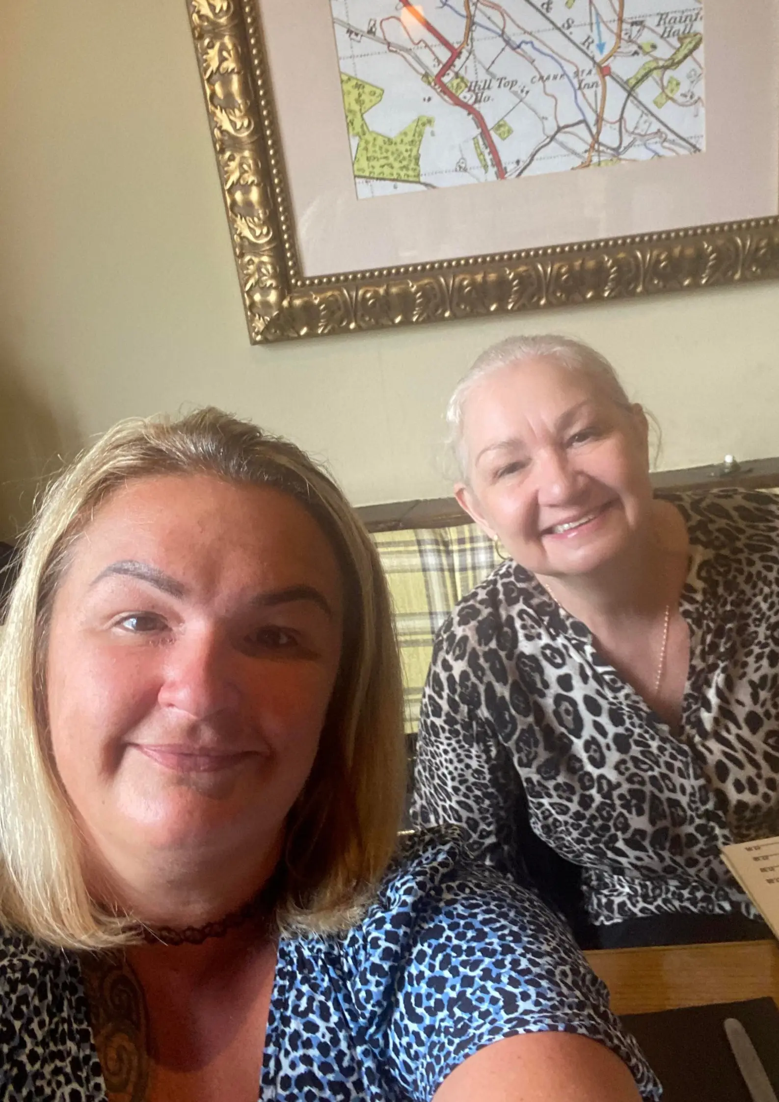 Nat's birthday celebrations landed her with a black eye.