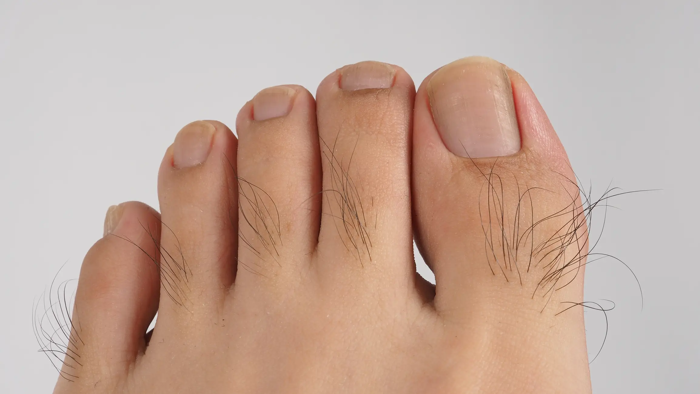 A doctor has opened up about what having hairy toes as a woman actually means for your health (Getty Stock Images)