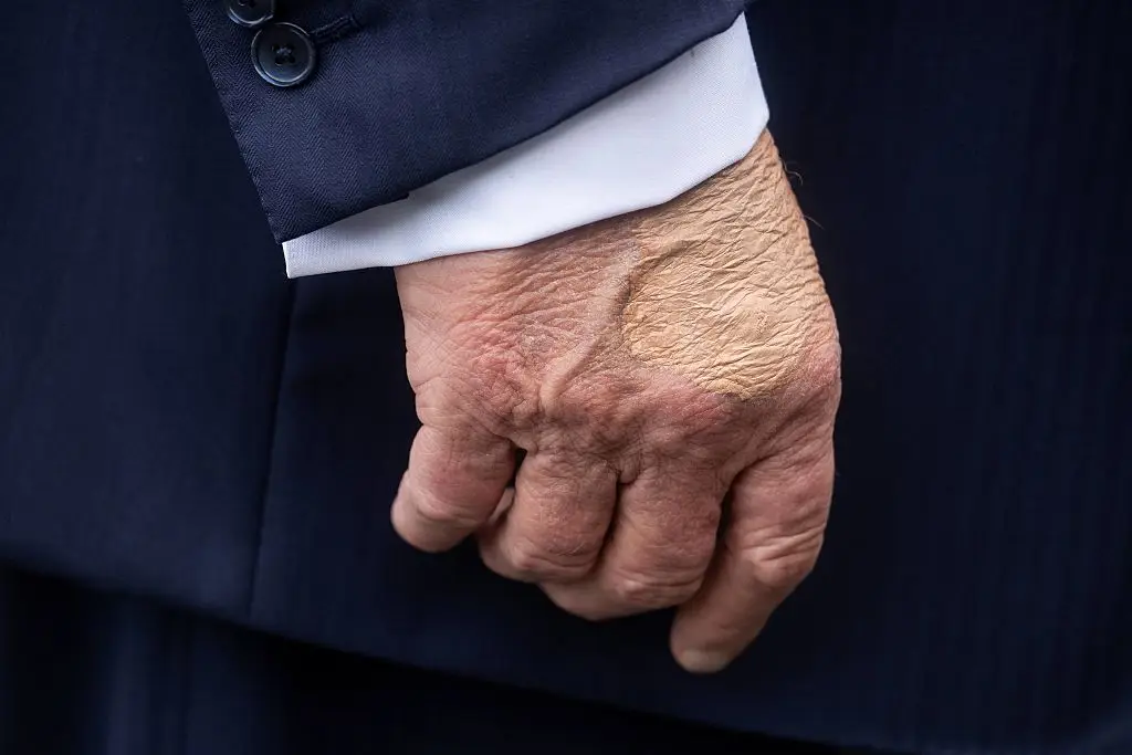 The 79-year-old Republican was spotted with body make-up covering up the bruise on his right hand (JIM WATSON / Contributor / Getty Images)