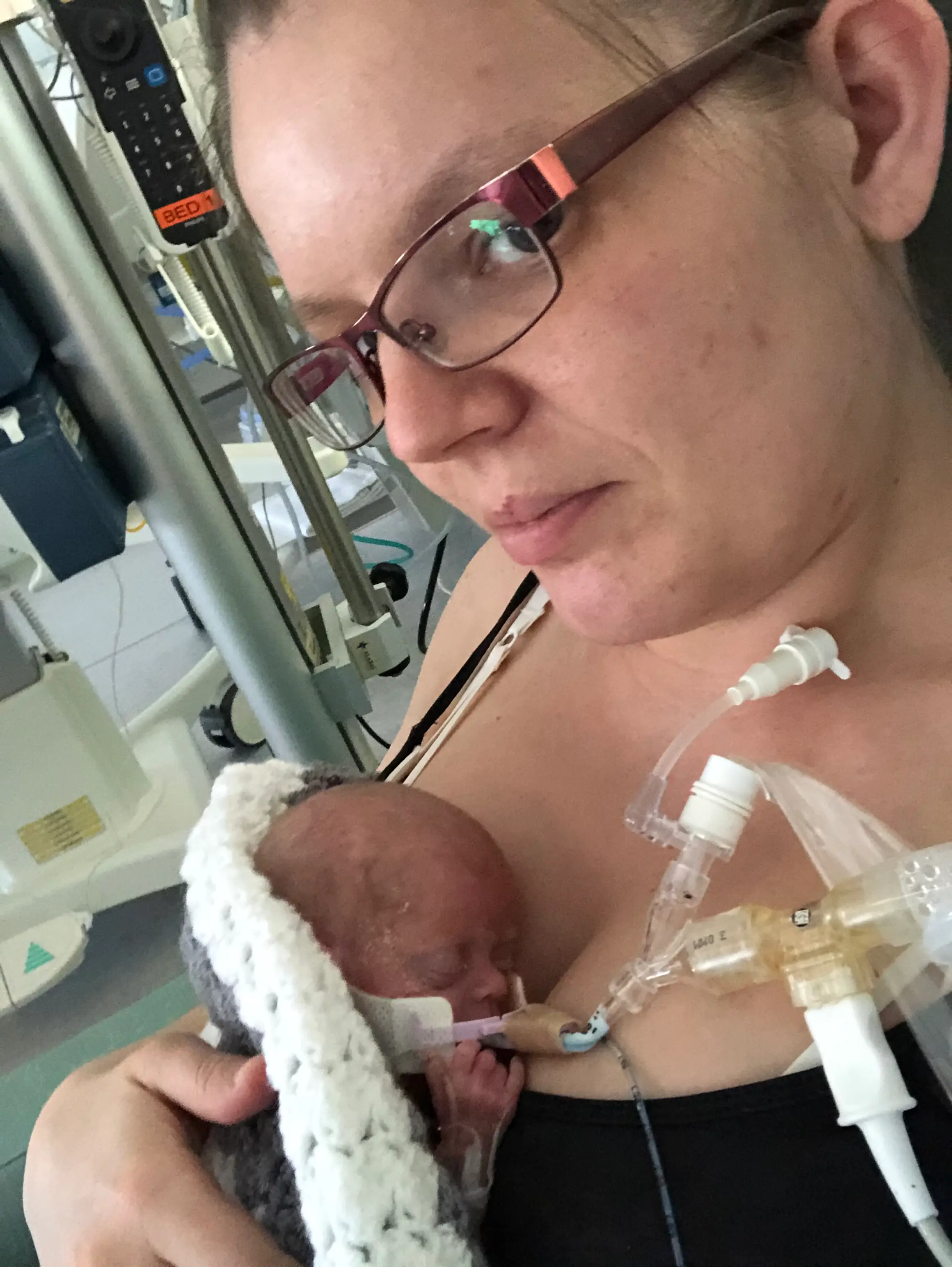 Michaela gave birth to the triplets at just 22 weeks and five days.