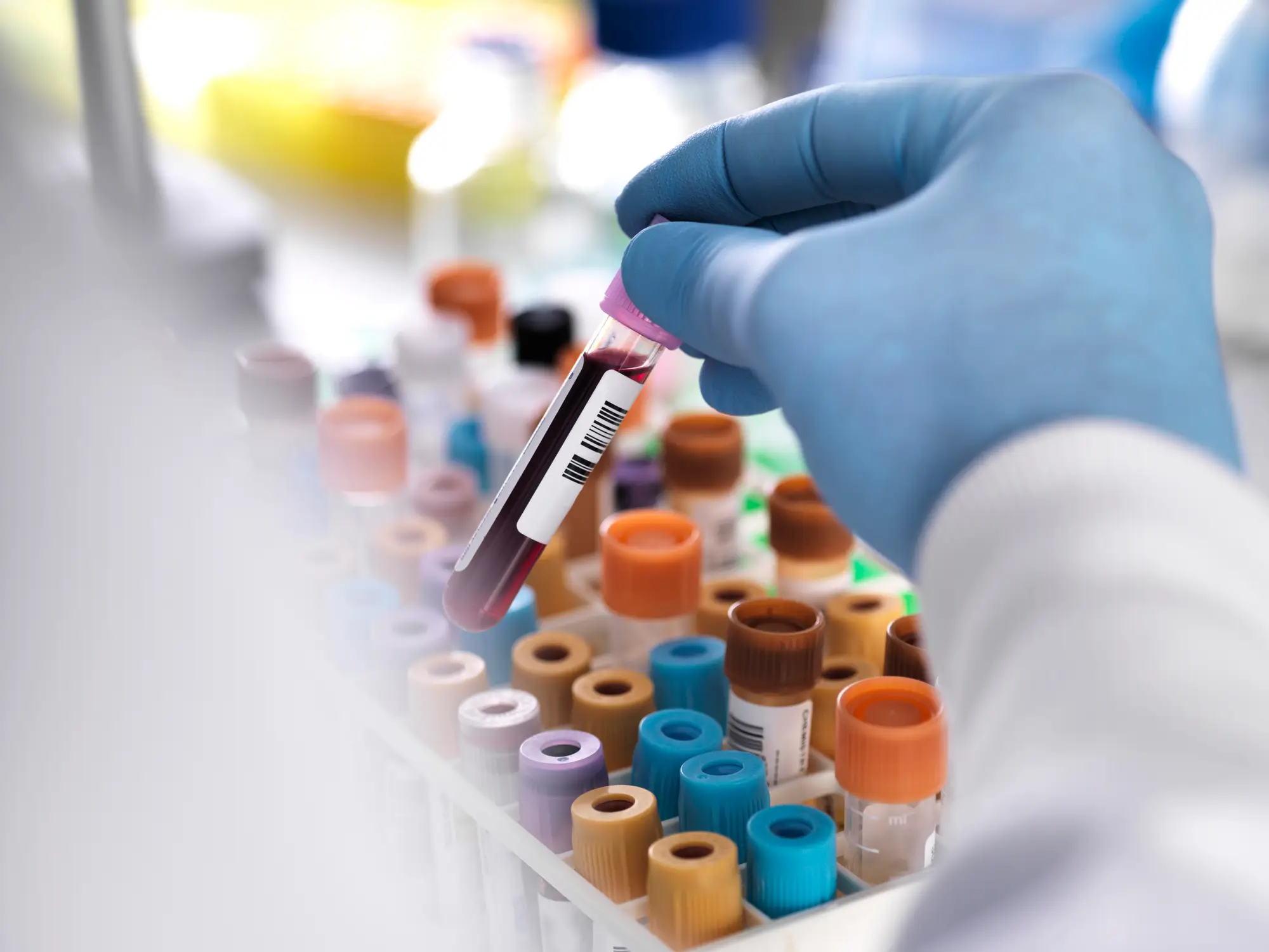 She now gets regular blood tests following surgery and chemotherapy.