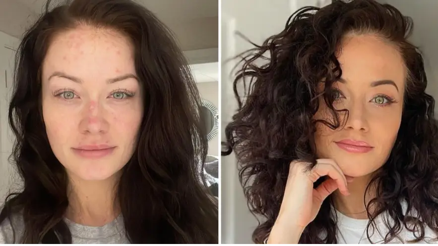 Jess Impiazzi thought she was dying before being diagnosed with incurable condition