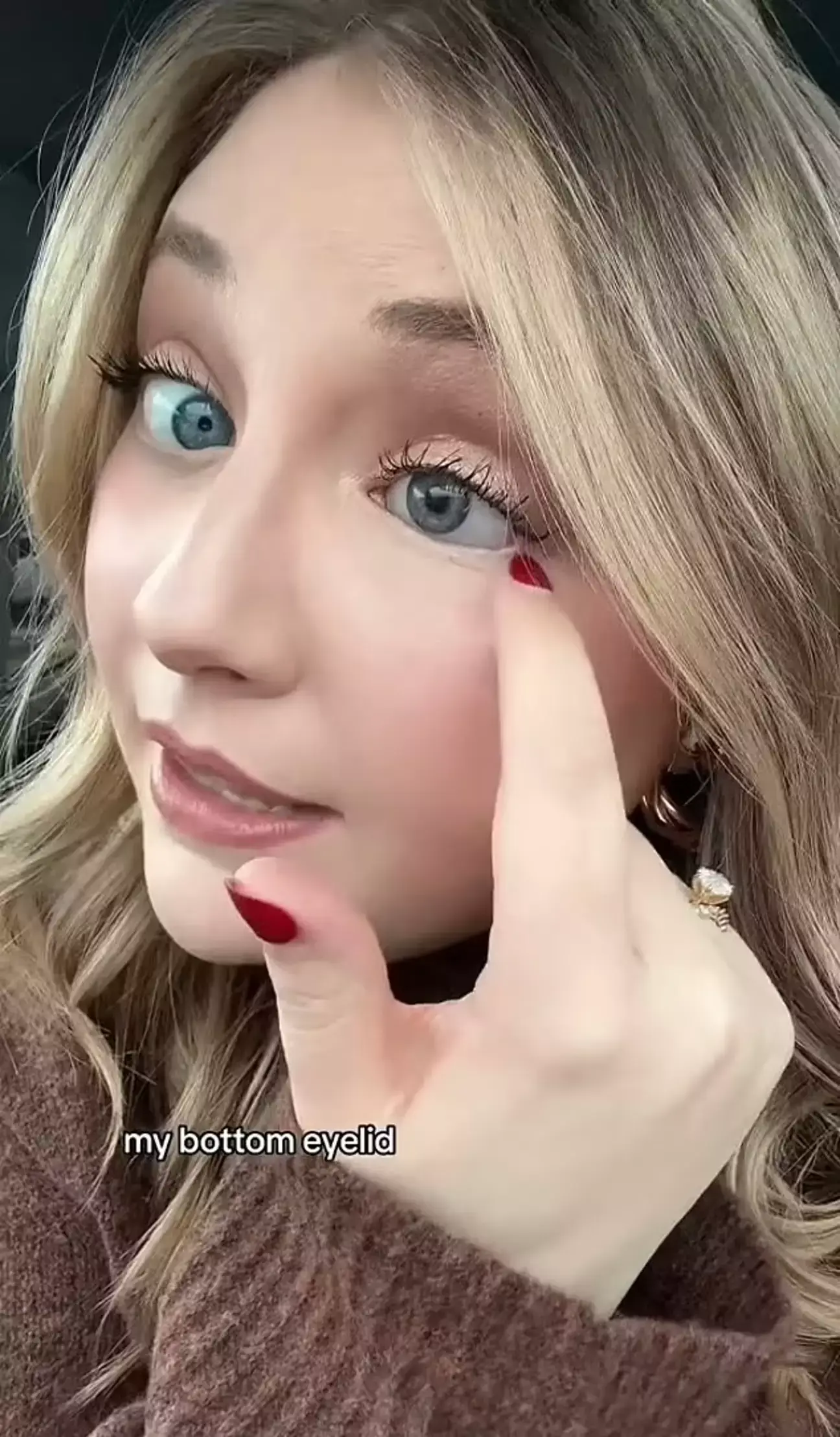 The 29-year-old has since used her story to raise awareness on the dangers of shattering sunglasses.