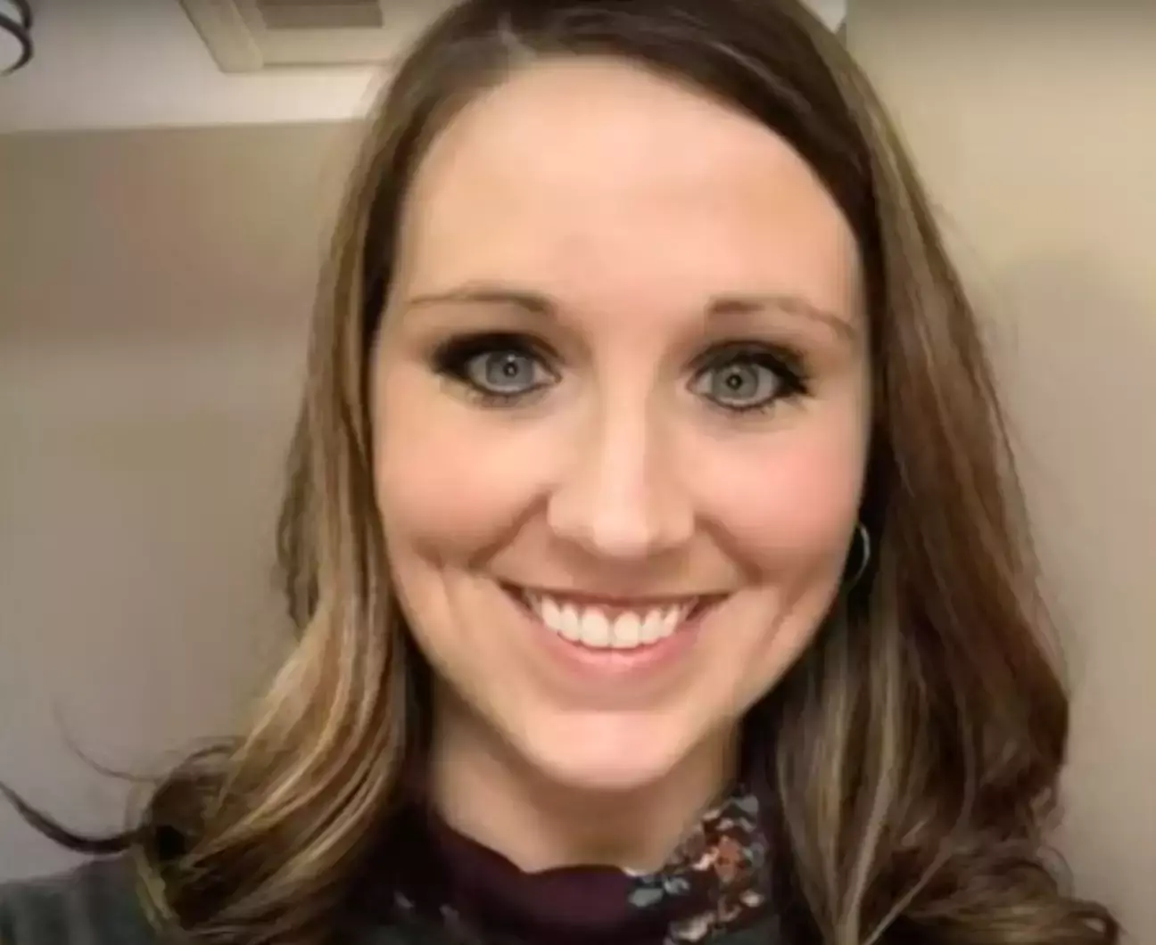 Ashley Summers died due to water intoxication.