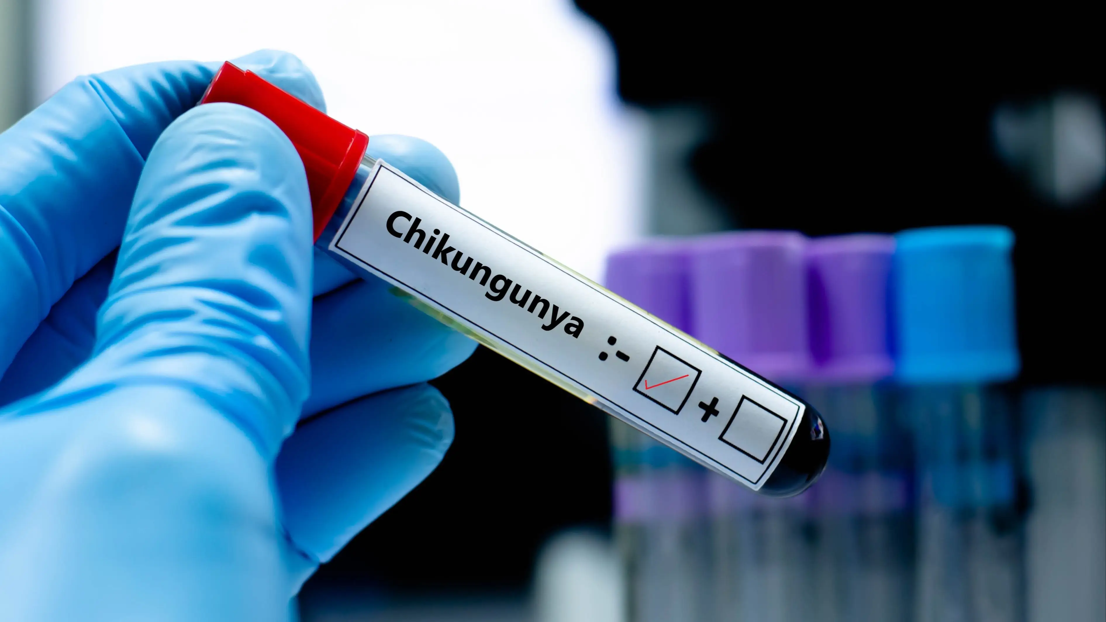 Doctors issue warning over symptoms of 'Chikungunya virus' as US state confirms first case in 6 years