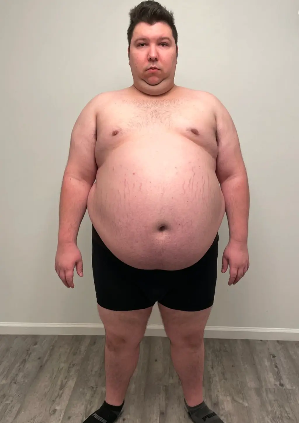 The YouTuber claimed earlier this month to have lost 250 of the pounds he gained while creating Mukbang content (Instagram/@real_nikocado)