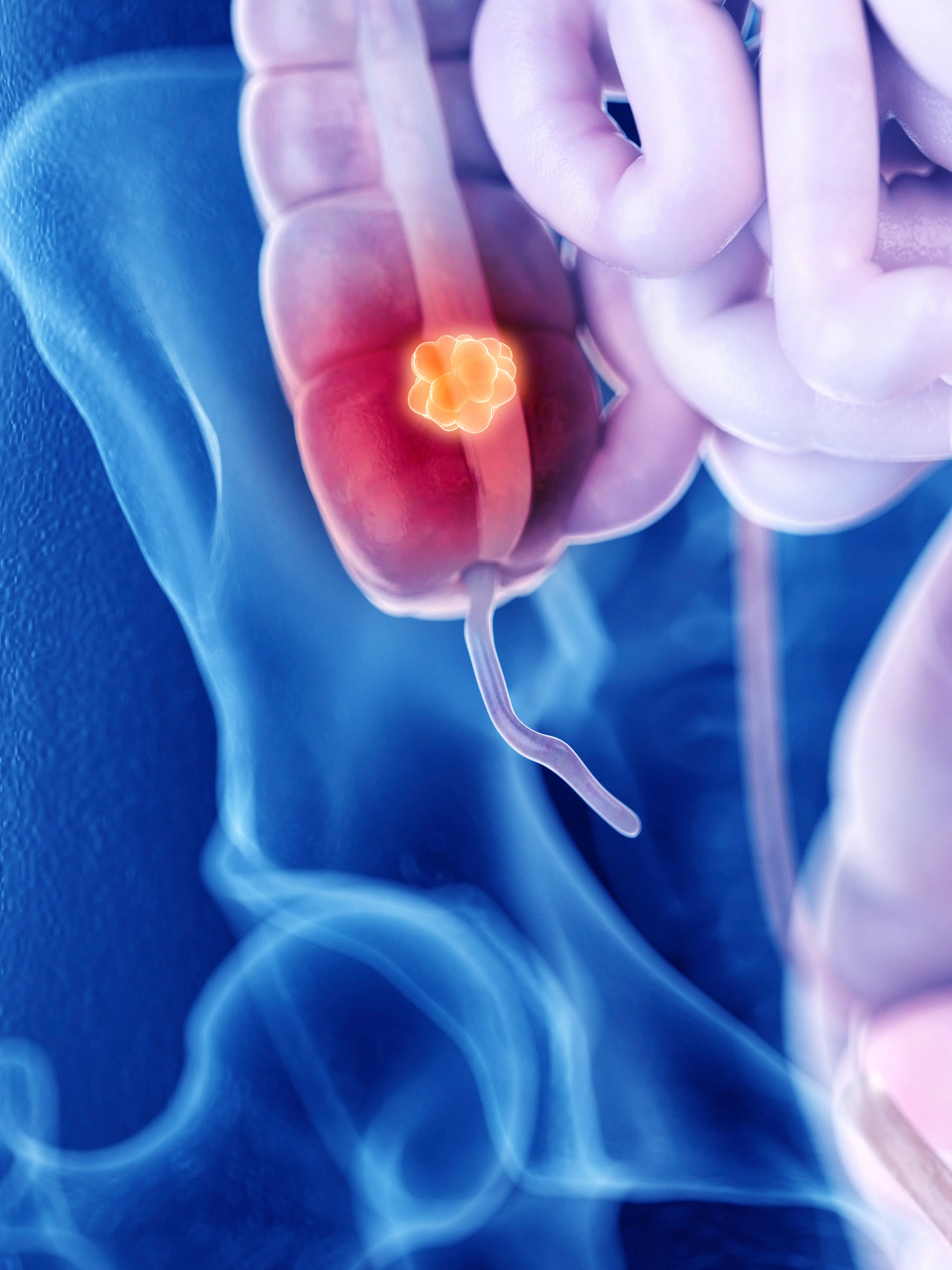 The appendix forms part of the digestive system (Getty Stock Image)