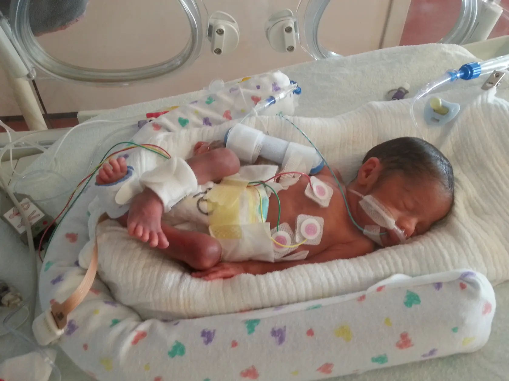 The mum said there are babies who have not been treated simply because of their postcode.