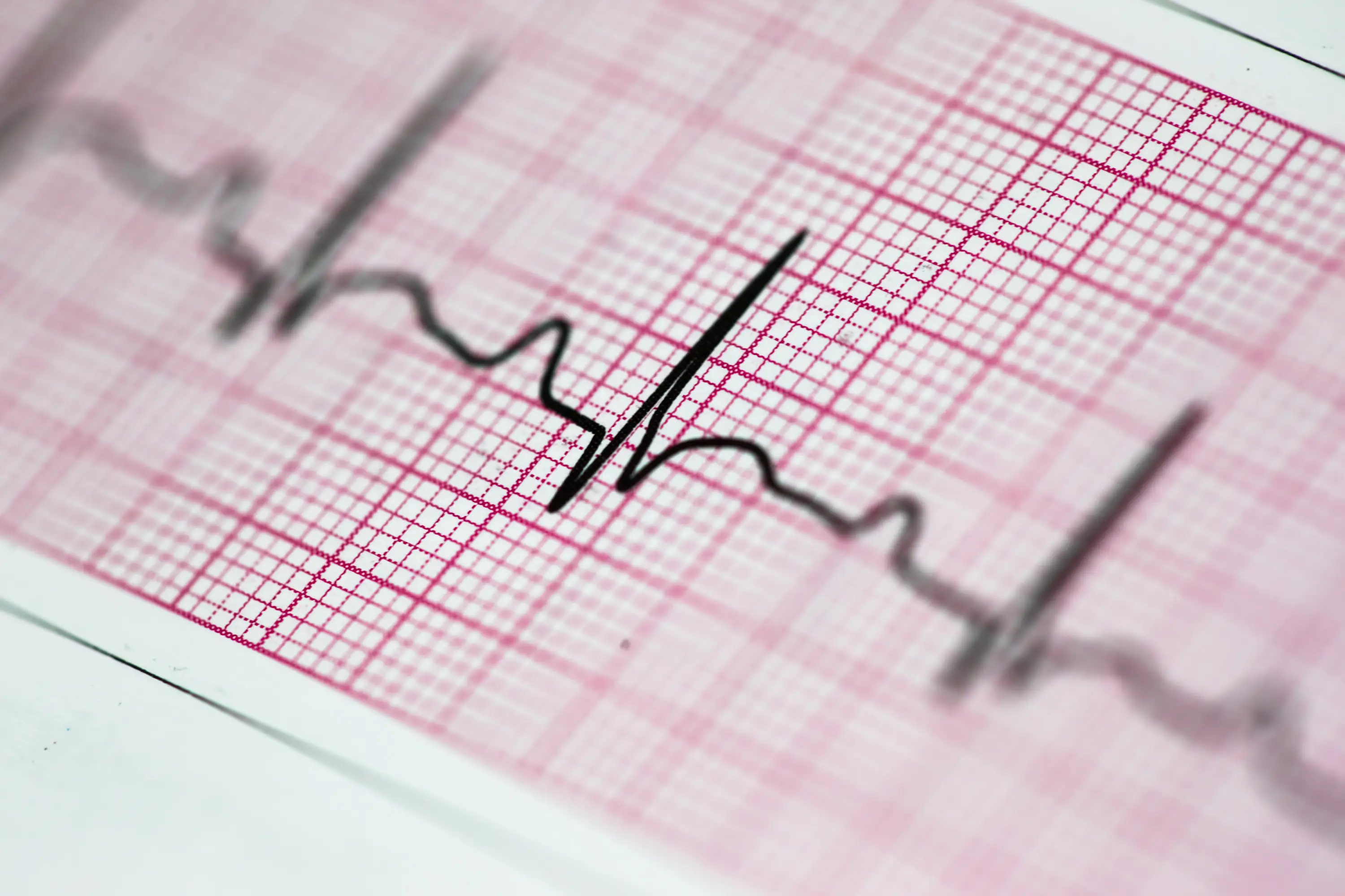 Tests can include tracking your heart rate while you sleep (Mutlu Kurtbas/Getty stock photo)