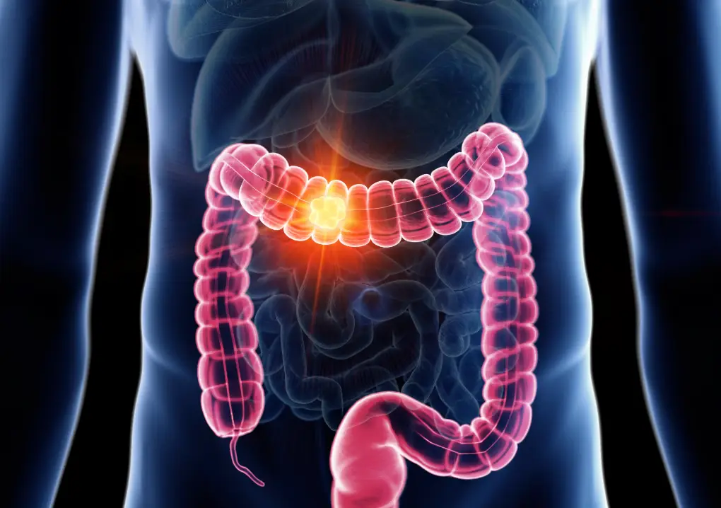 There are several symptoms to look out for (Getty stock photo)