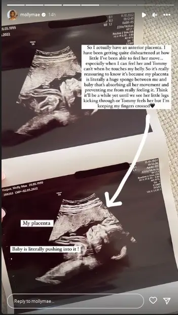 The influencer explained the reasoning to her followers.