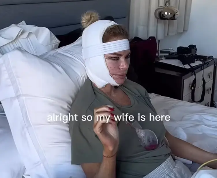 Caroline Stanbury said she looked as if she had been in a 'car crash'.