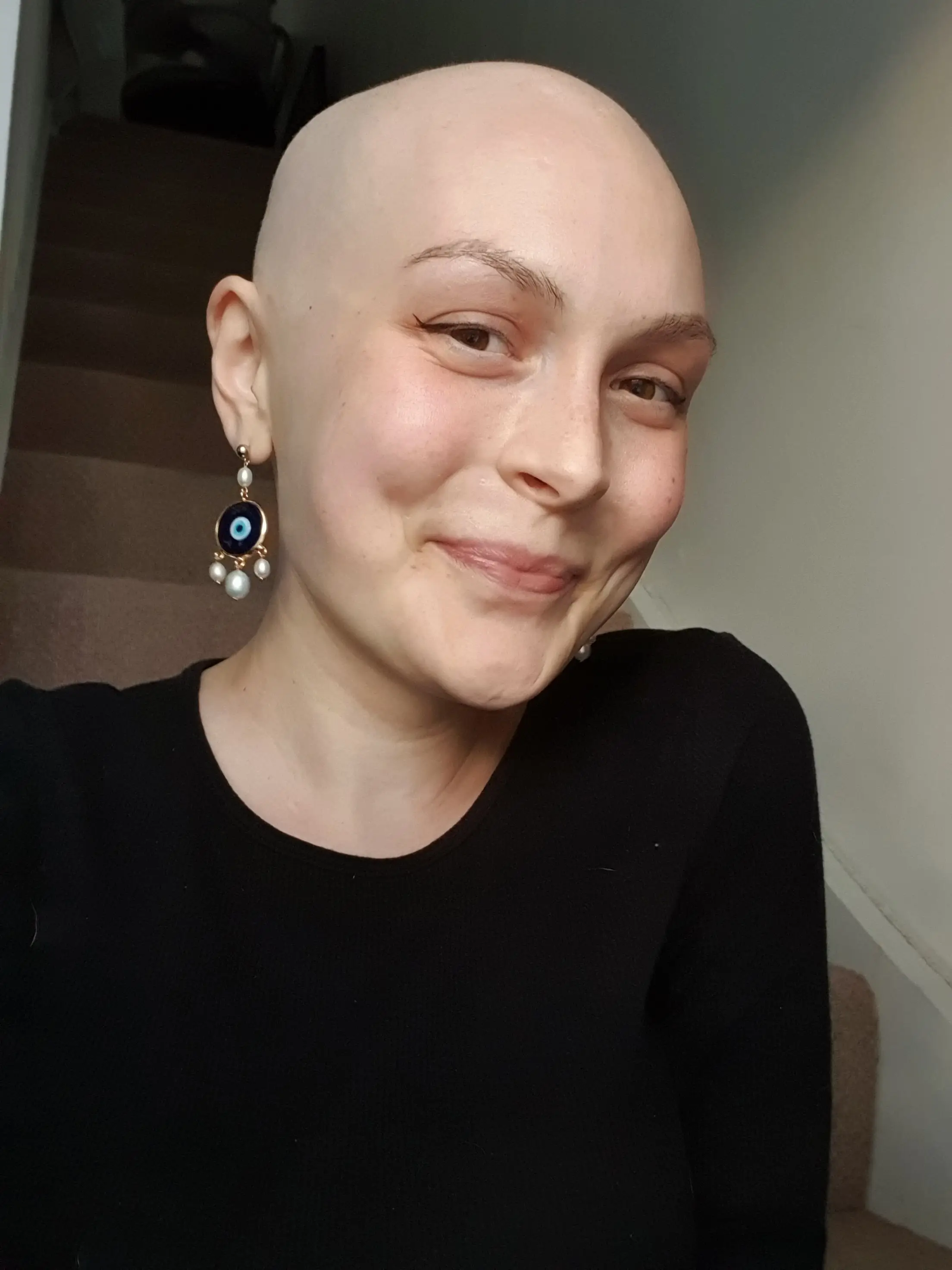 Chloe started chemotherapy as soon as she was diagnosed.