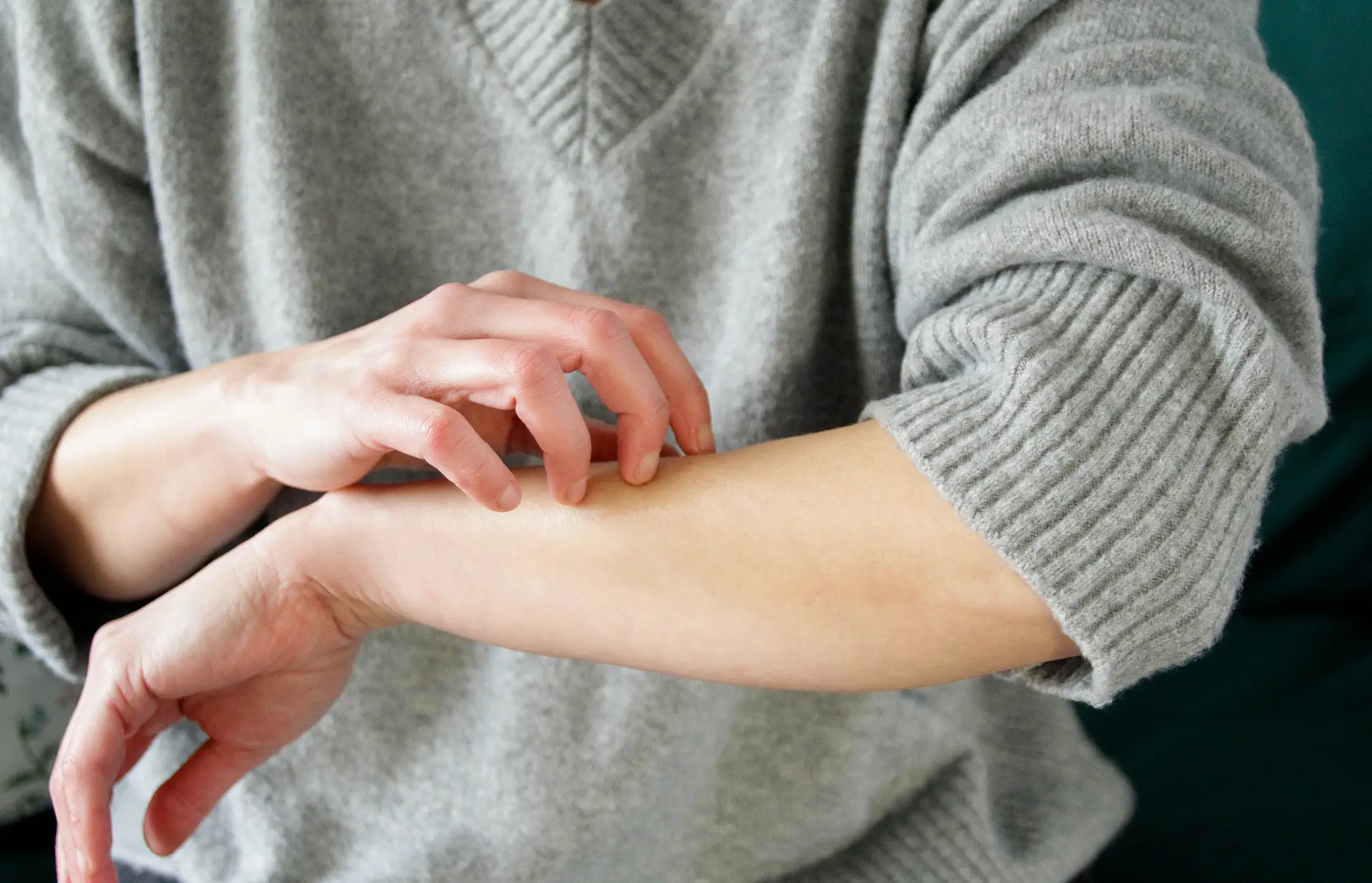 Itchy skin can also be a symptom (Getty Stock Photo)