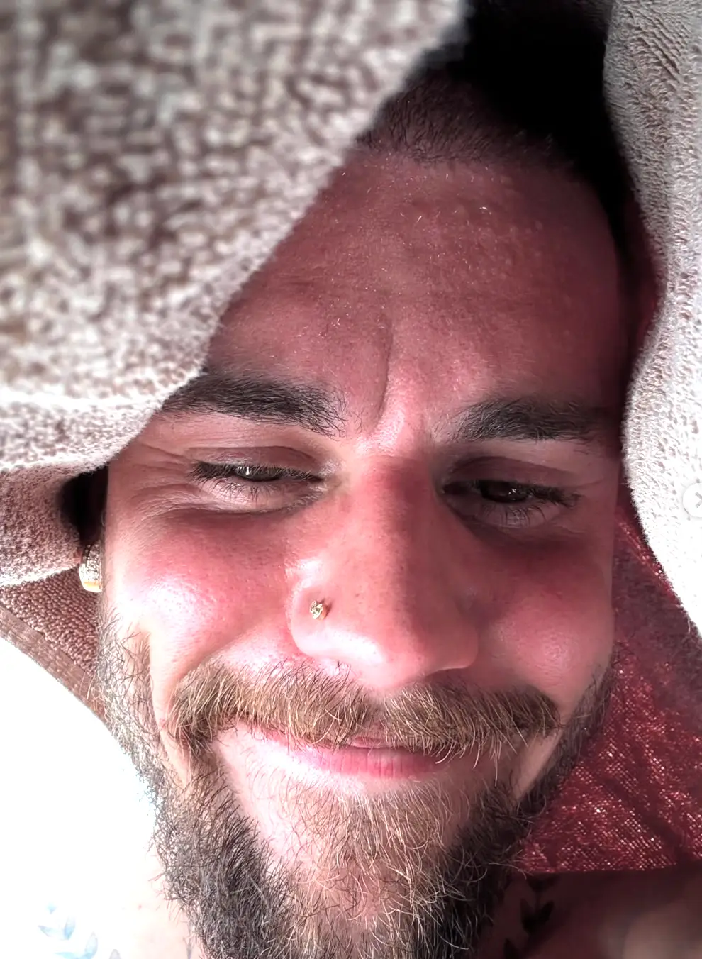 The hitmaker has been open about his struggles with the disease (Instagram/lilbieber)