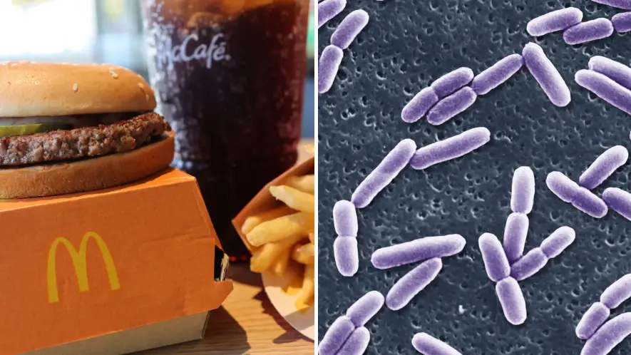 Michael M. Santiago/Getty Images/BSIP/Universal Images Group via Getty Images